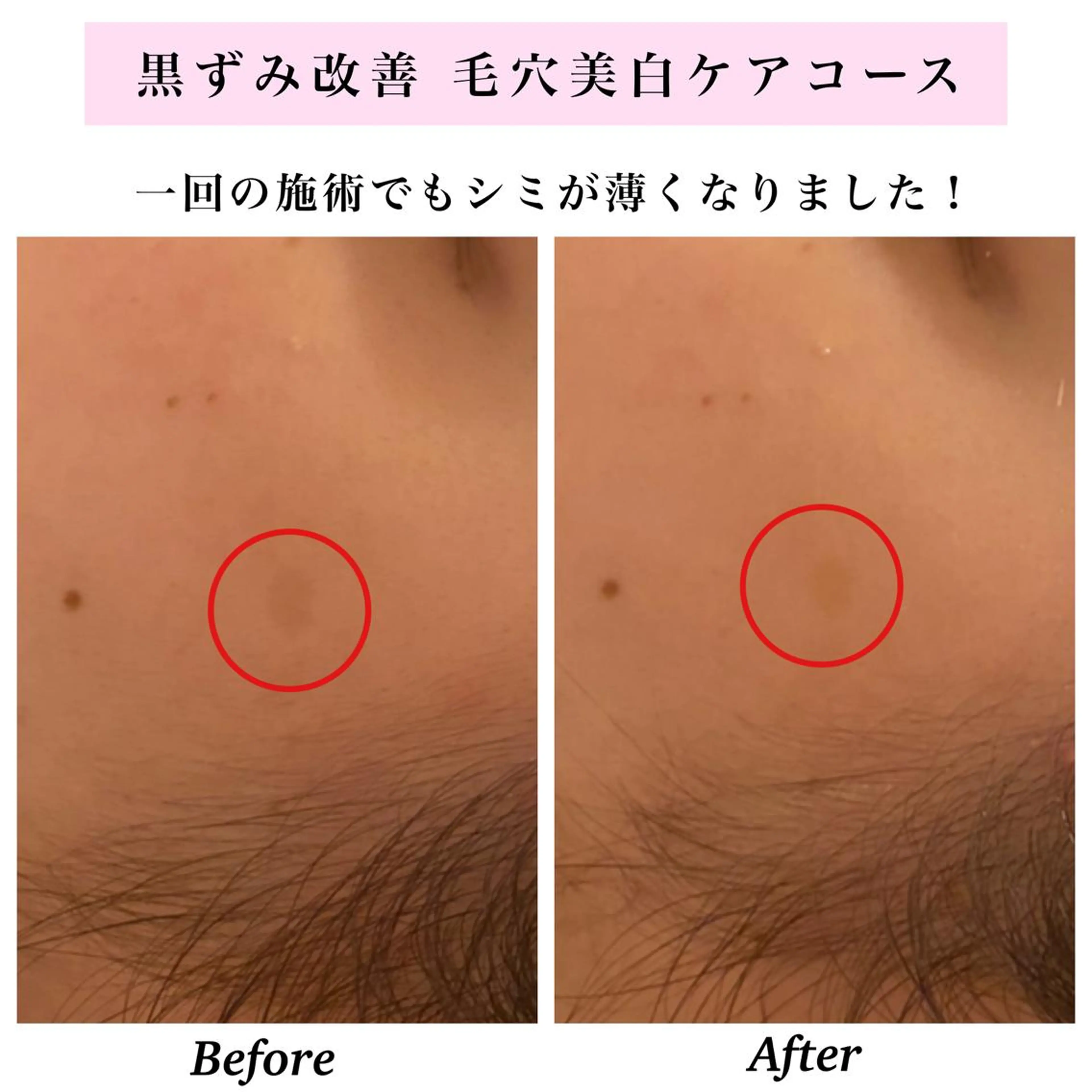 エステ リラク Bellesthe （ベルエステ）のエステ・リラクイメージ