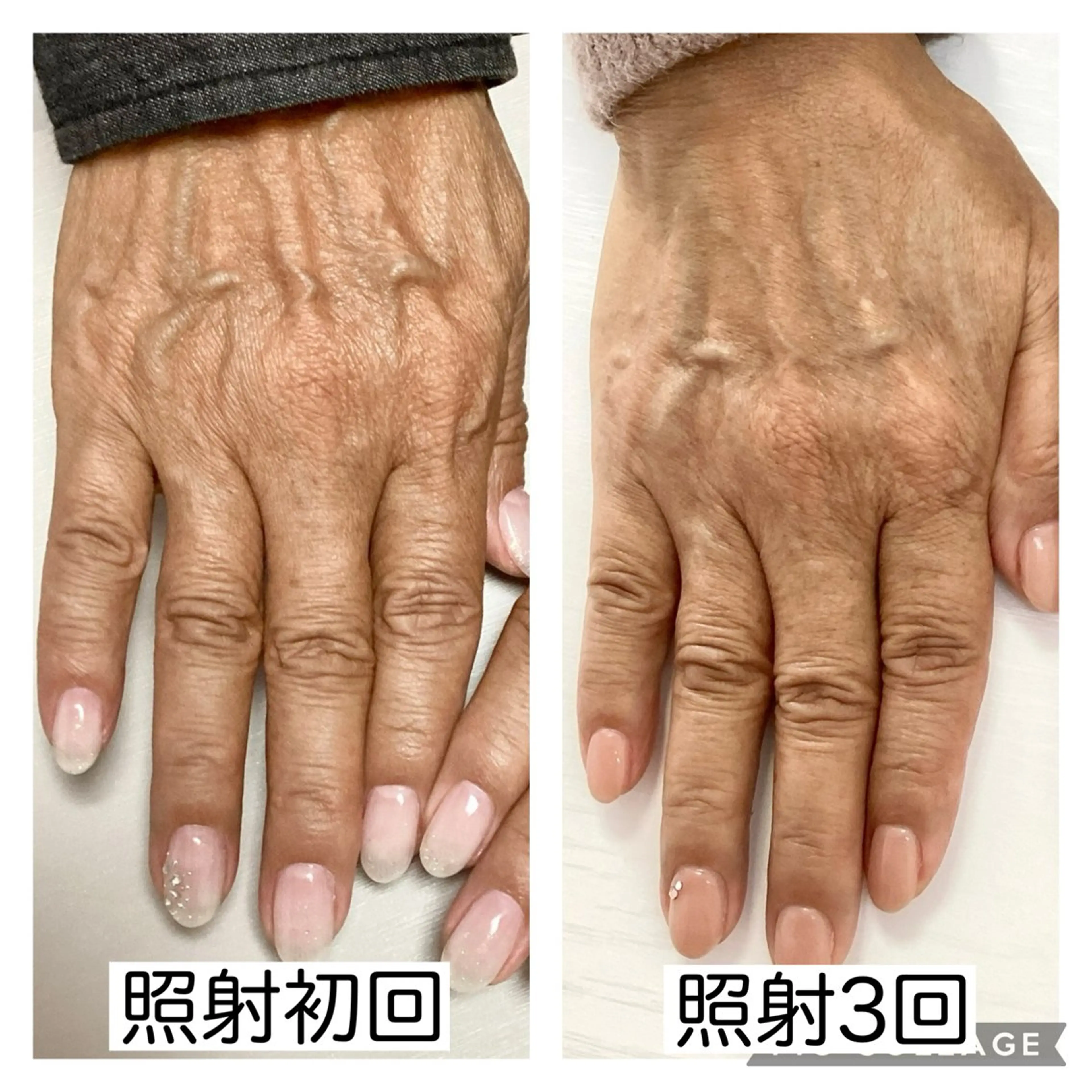 ネイル ハンドネイル ハンドケア Lilly nail Mikuのネイルデザイン