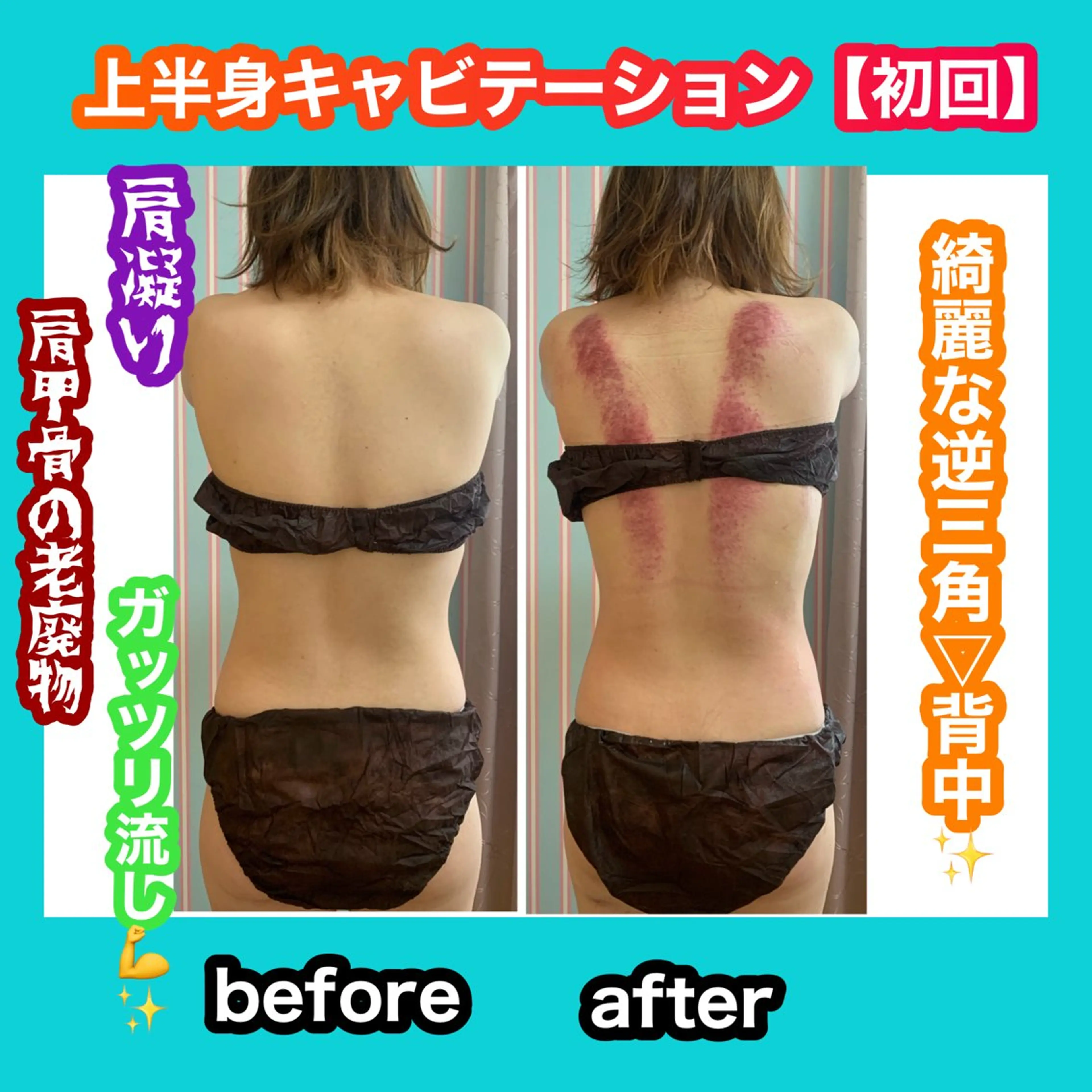 エステ リラク 痩身/脱毛/ネイル HARUKAのエステ・リラクイメージ