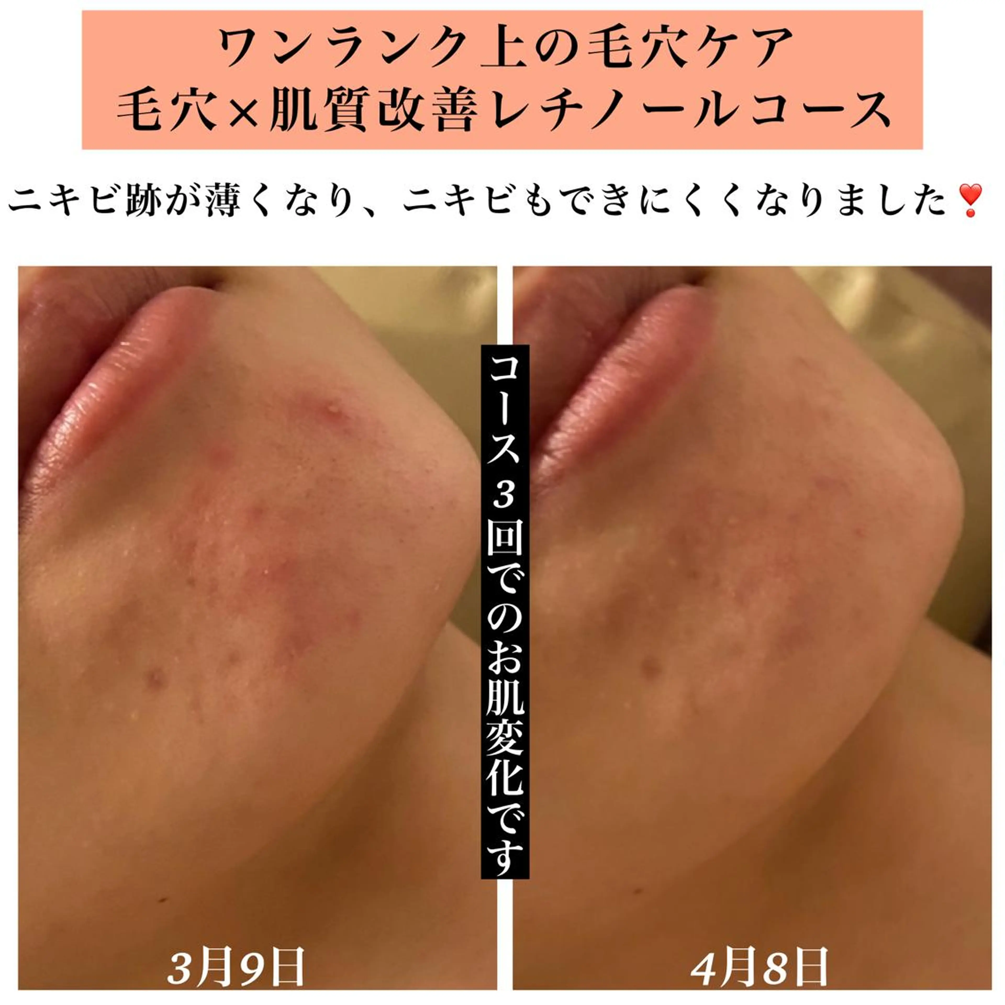 エステ リラク Bellesthe (ベルエステ)のエステ・リラクイメージ