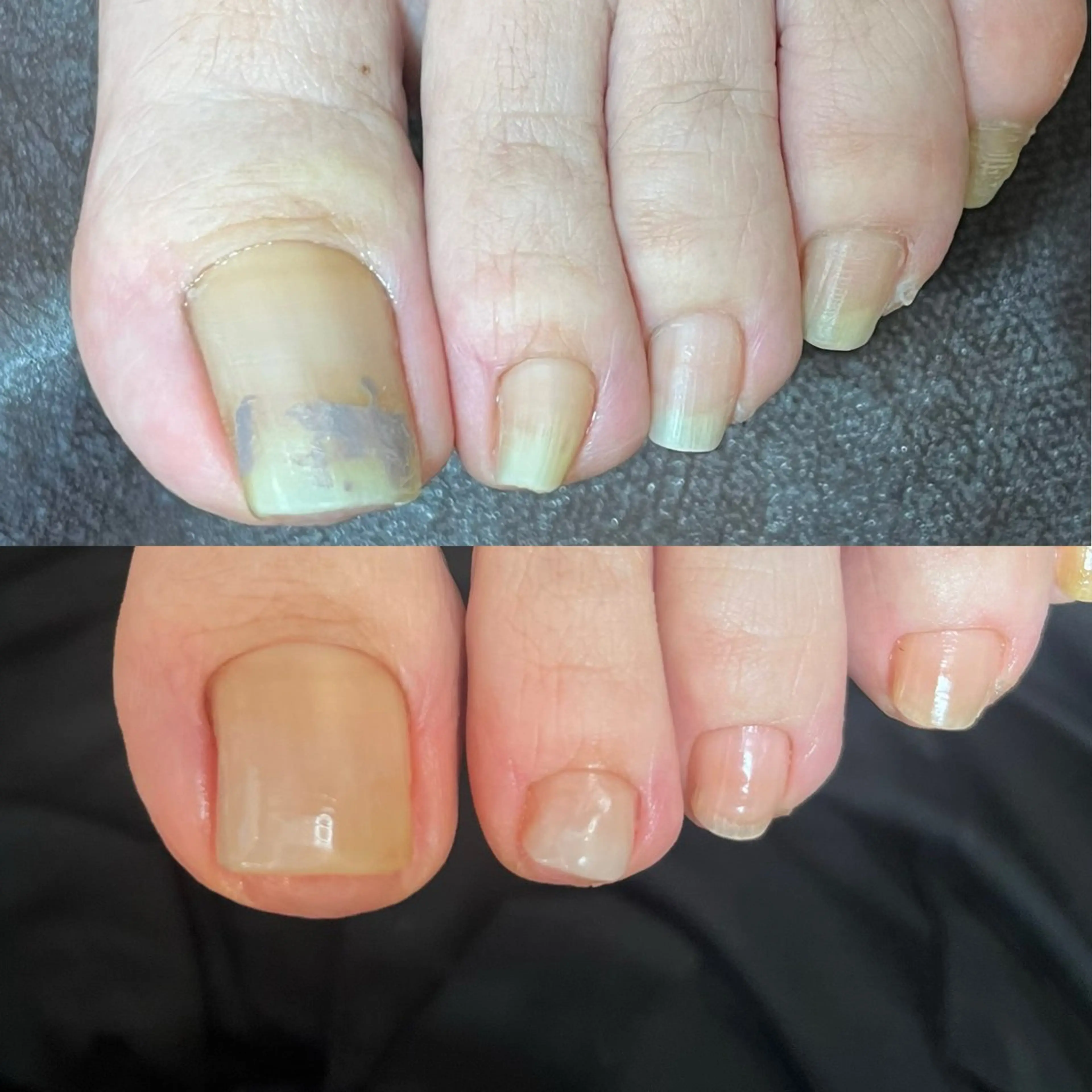 ネイル Atelier Masami 爪や所属・菊池 雅美のネイルデザイン