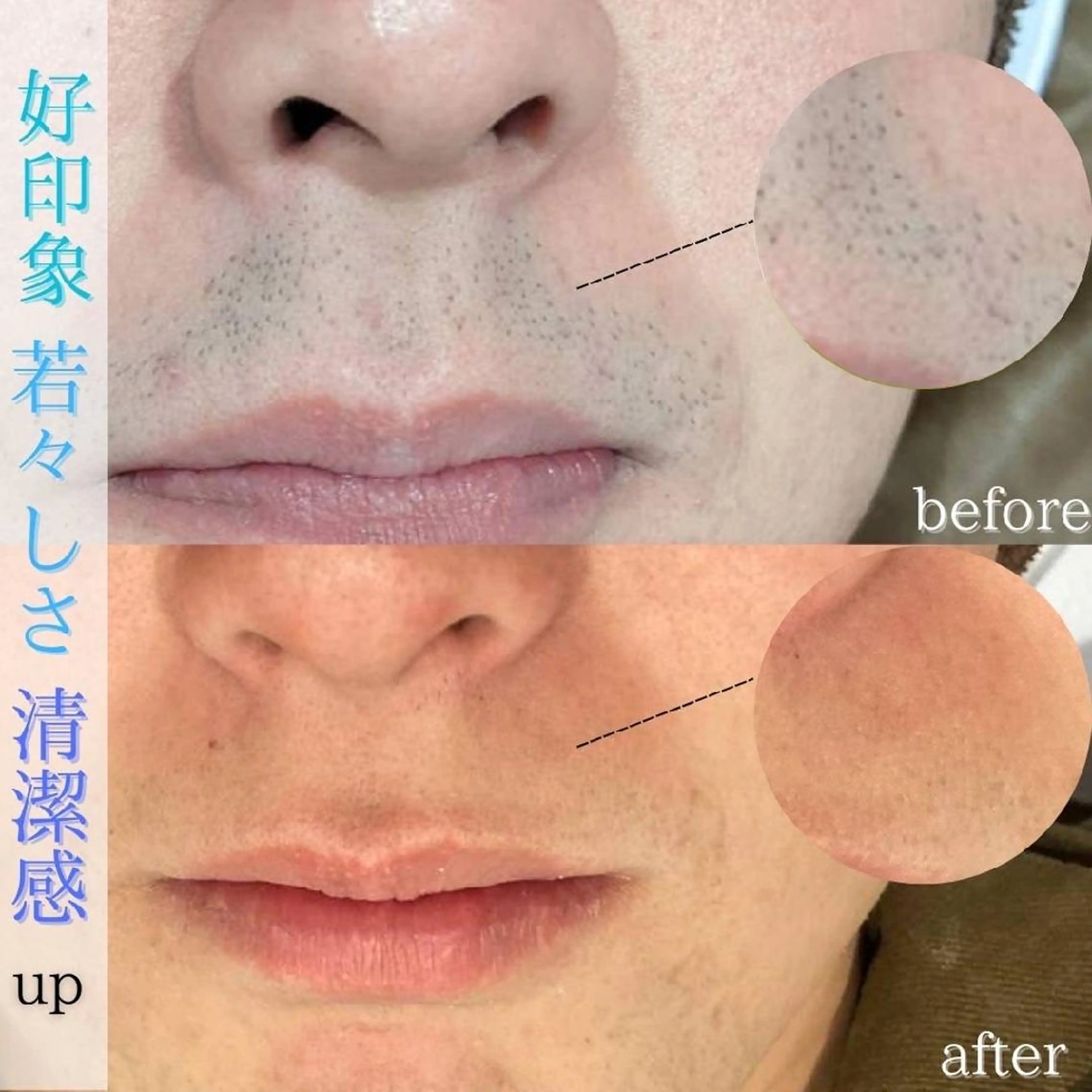 メンズ 脱毛 DahliaBeauty ダリアビューティー所属・春日井市Dahlia Beauty　中村のエステ・リラクイメージ