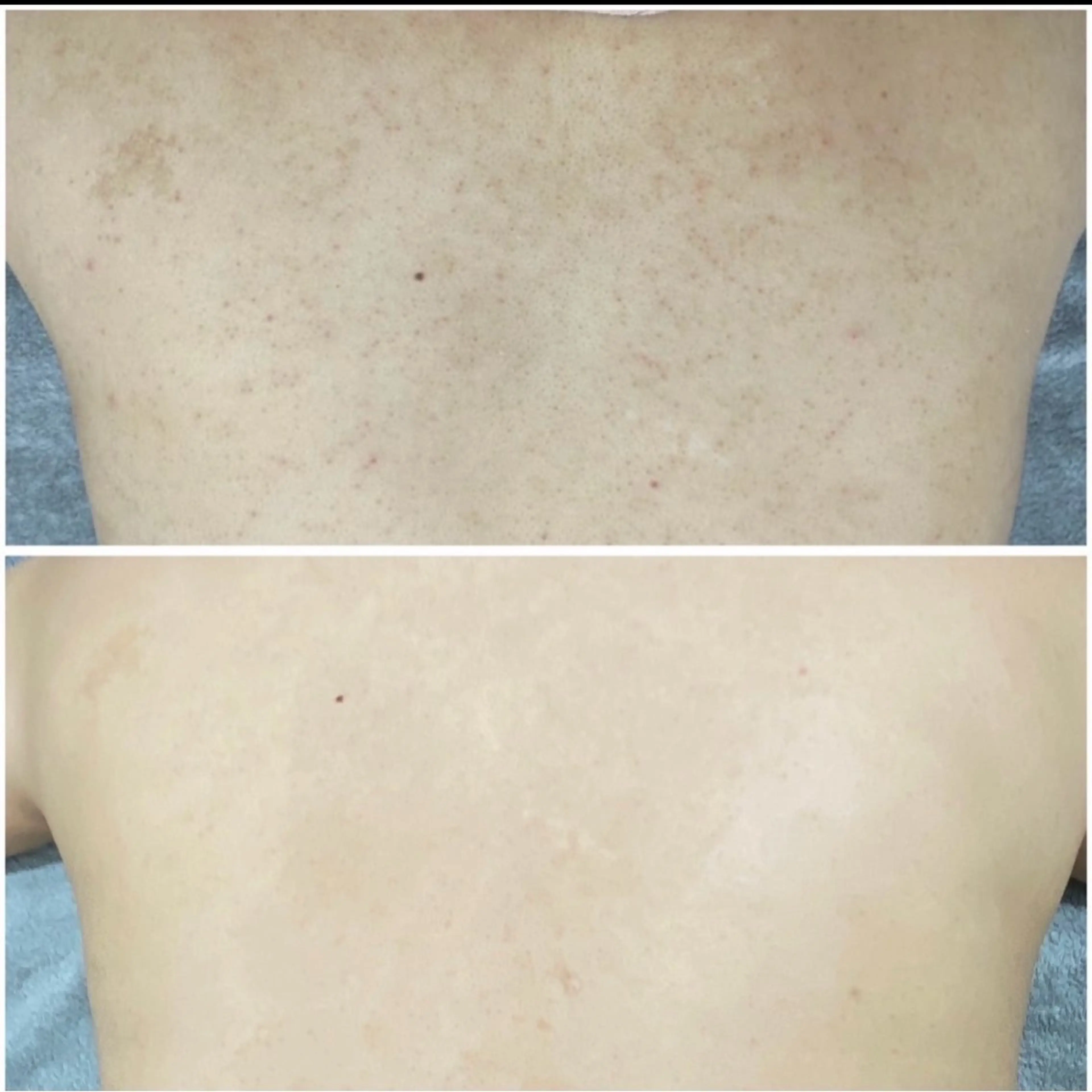 エステ エレファンテブランコ所属・mori yukariのエステ・リラクイメージ