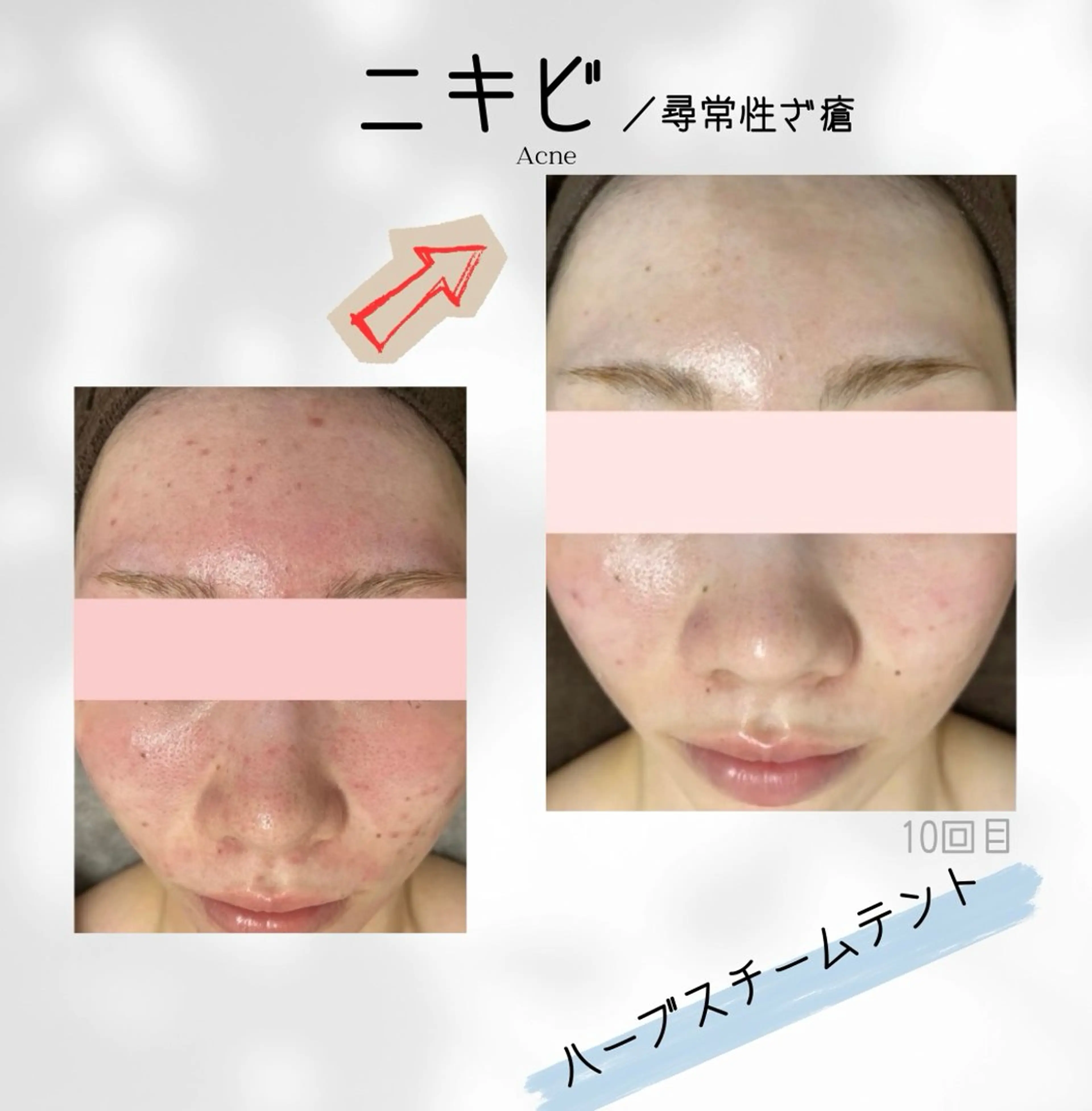 エステ リラク ハーブ蒸しサロン🌿 香嬉琉🌿きよかのエステ・リラクイメージ