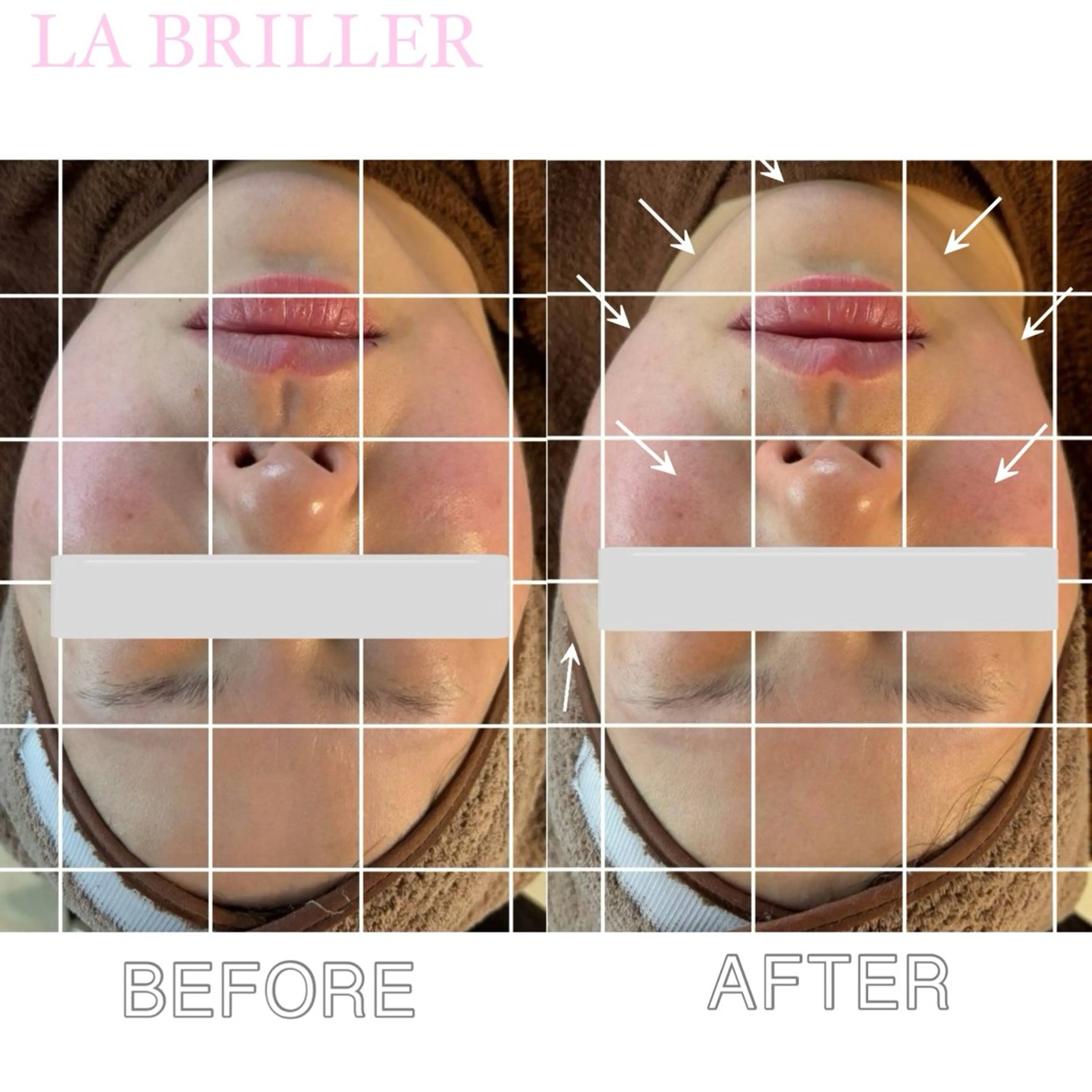 エステ LA BRILLERのエステ・リラクイメージ