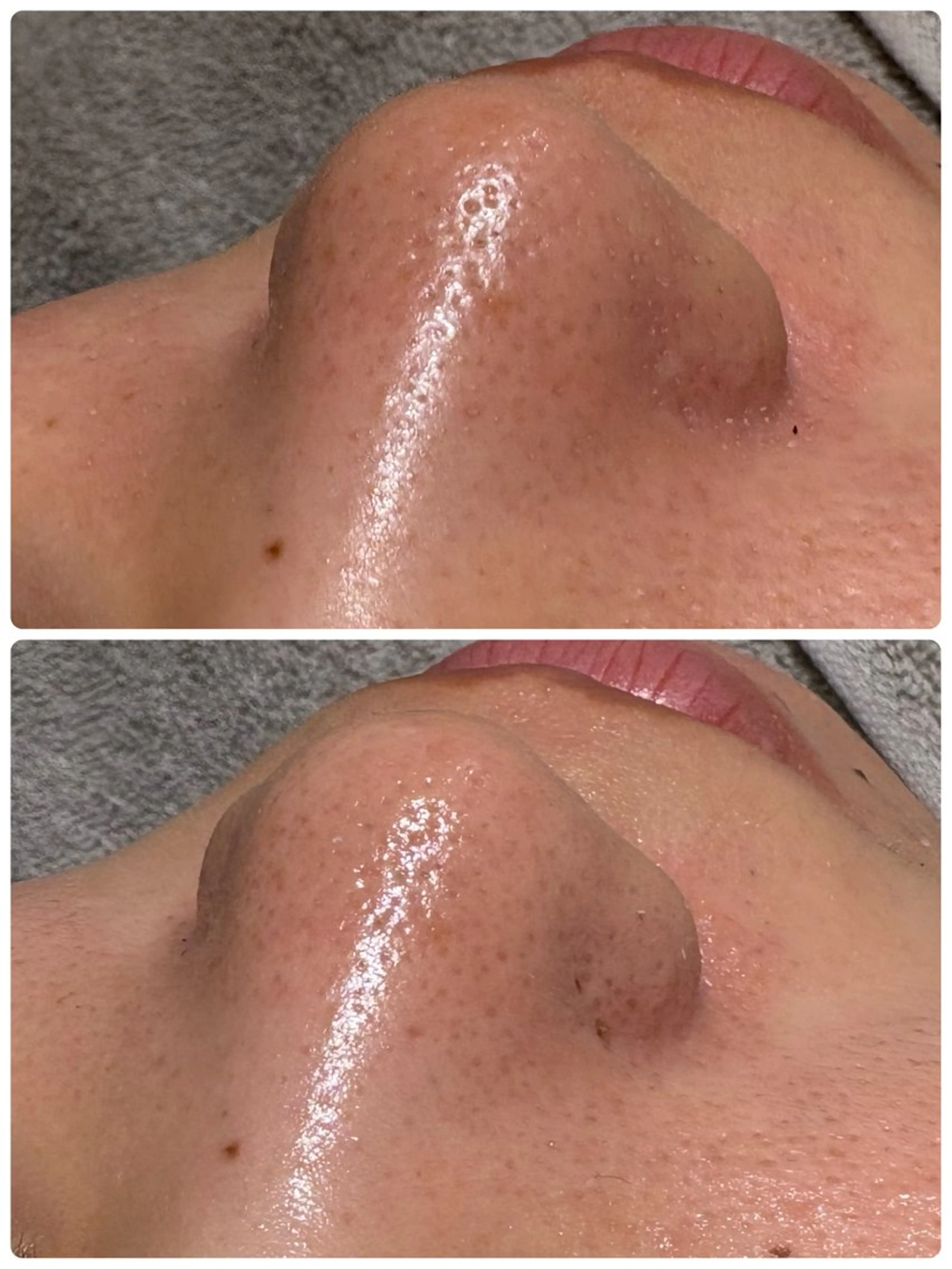 エステ /ulu  soin所属・太田 玲奈のエステ・リラクイメージ