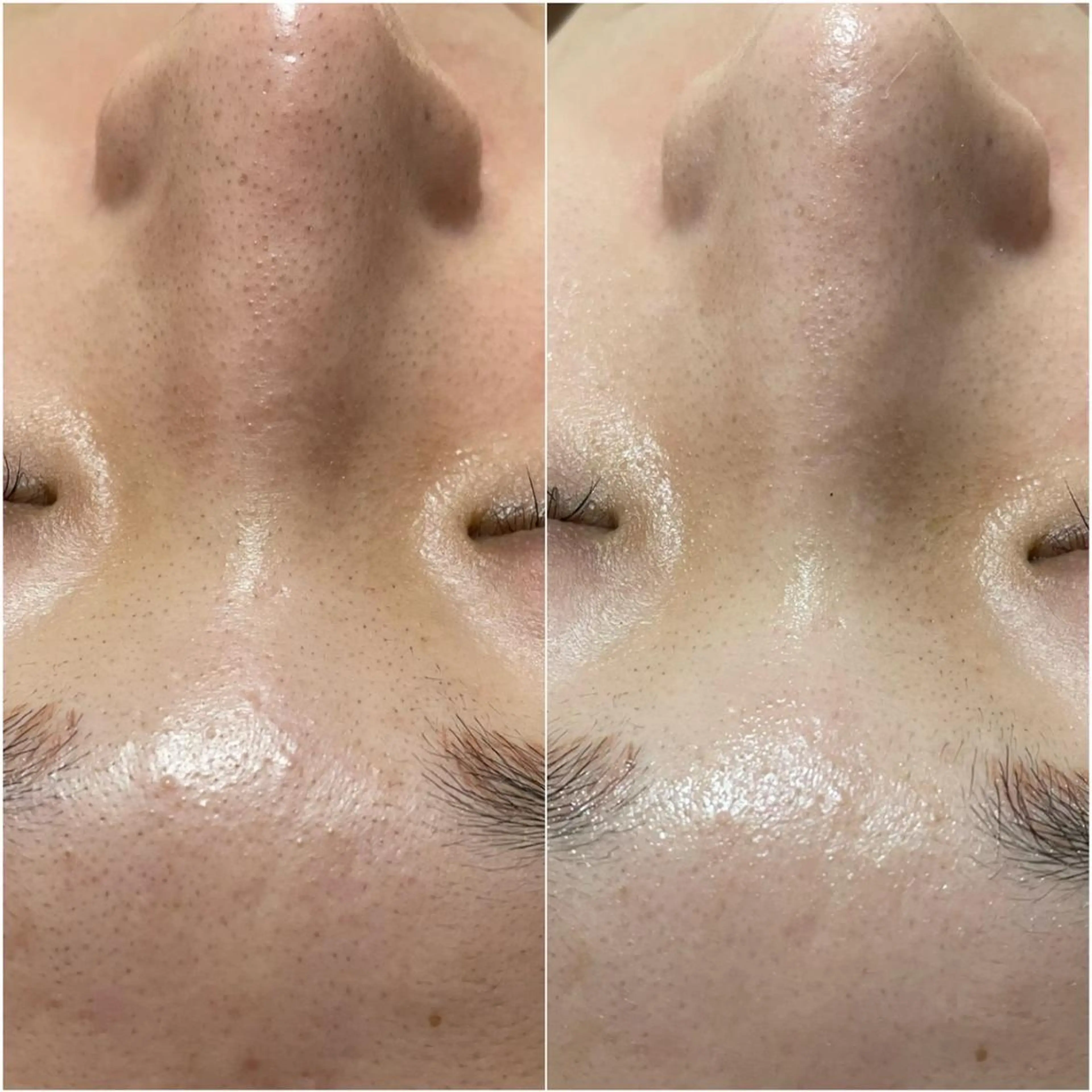 エステ ✨美肌水光✨ アトリエリュバンのエステ・リラクイメージ