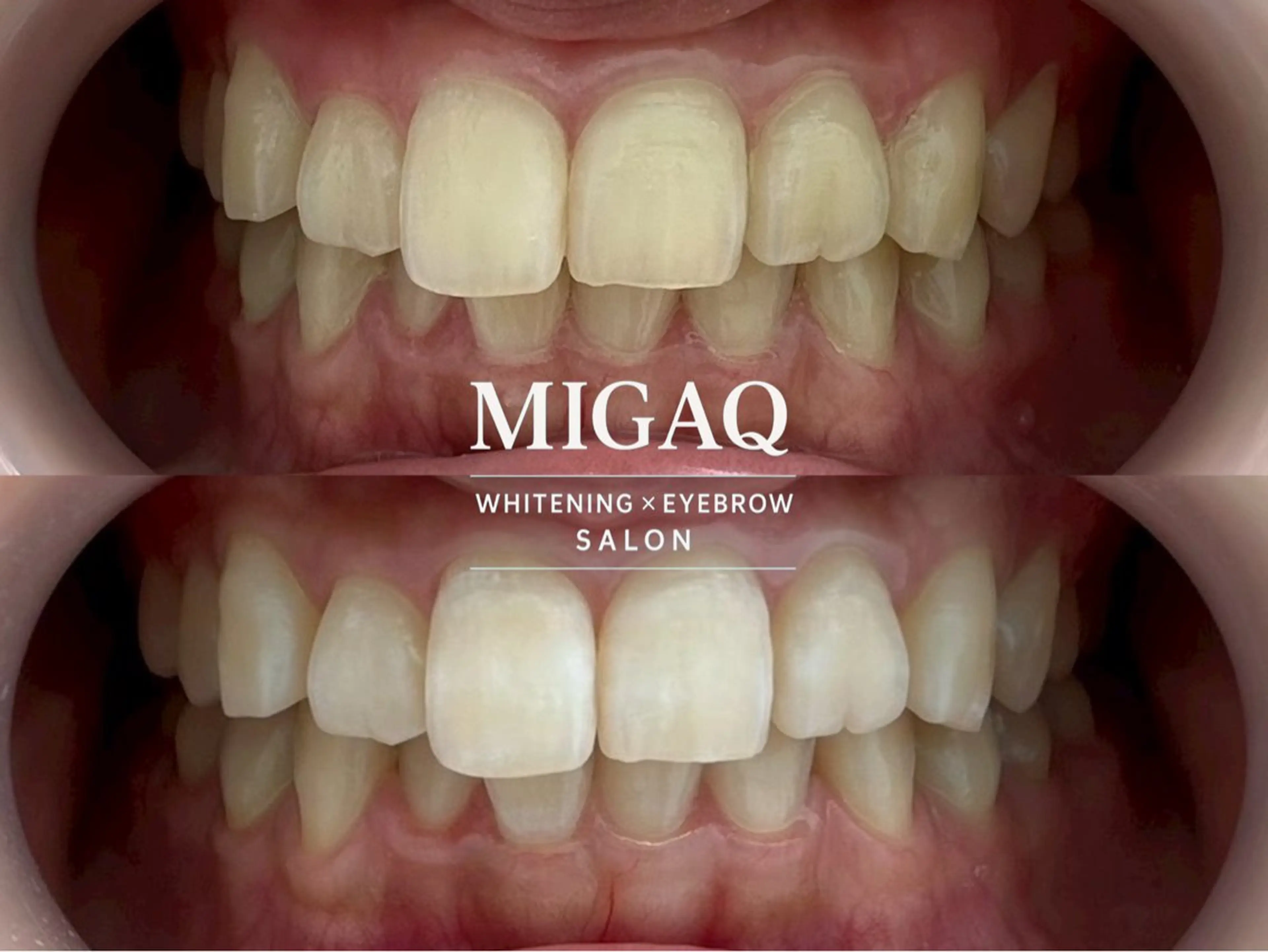 歯のホワイトニング専門店 MIGAQ 京都四条大宮店所属・佐藤 未来のその他イメージ