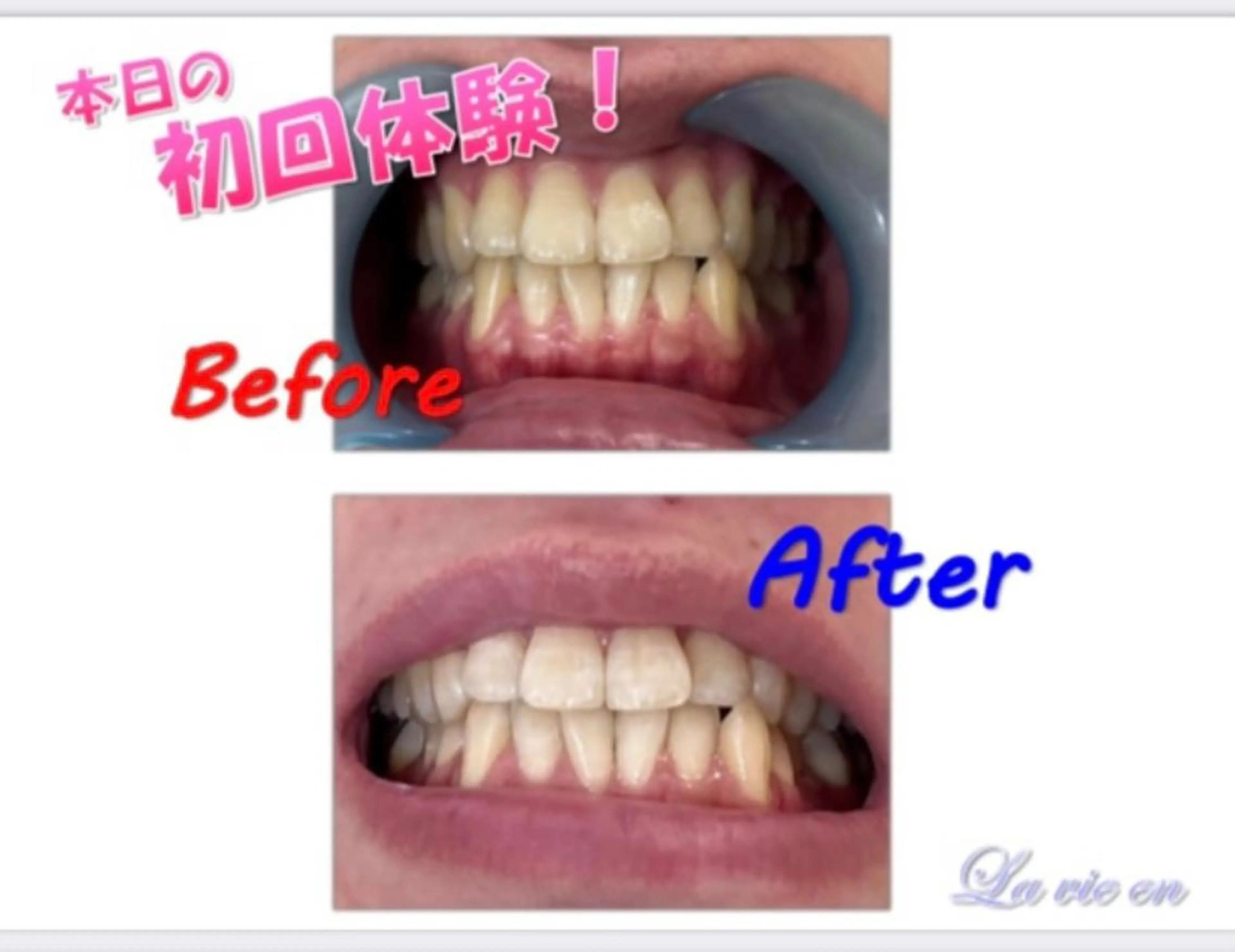 その他 セルフホワイトニングサロン　ラヴィアン所属・ホワイトニングサロン La vie enのその他イメージ