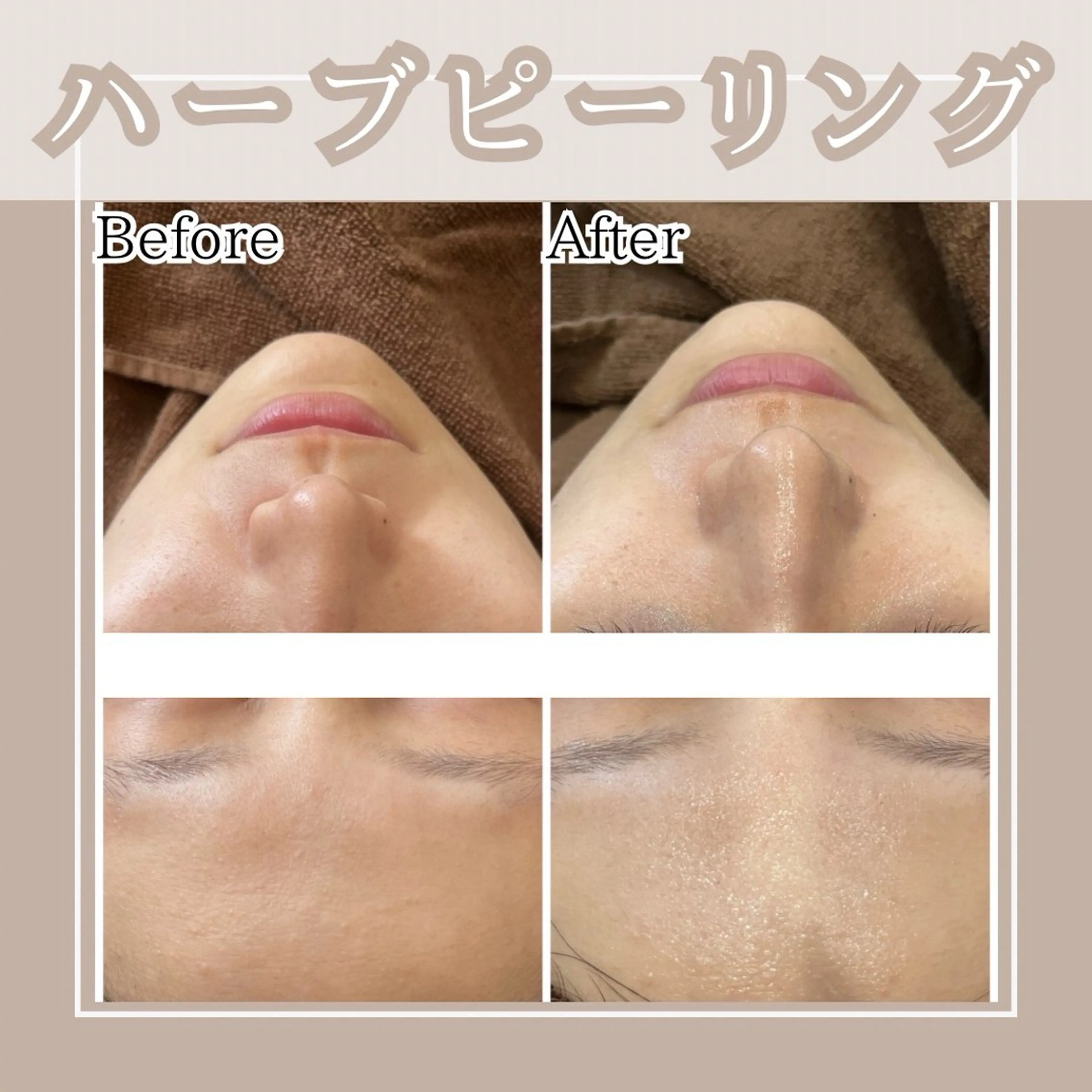 メンズ キッズ Amaryllis 🌹松本のエステ・リラクイメージ