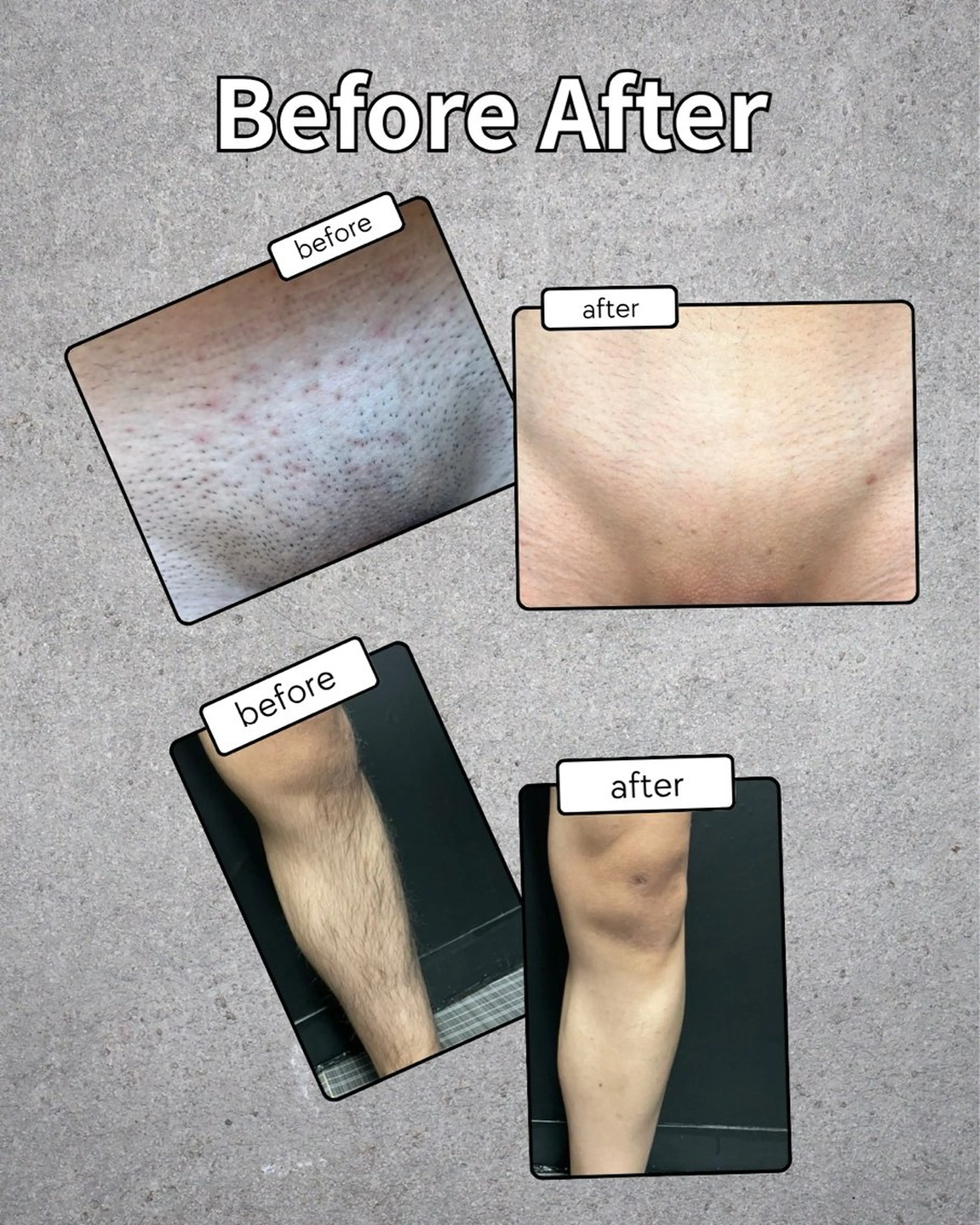 メンズ 脱毛 Neosalon所属・Neosalon ネオサロンのエステ・リラクイメージ