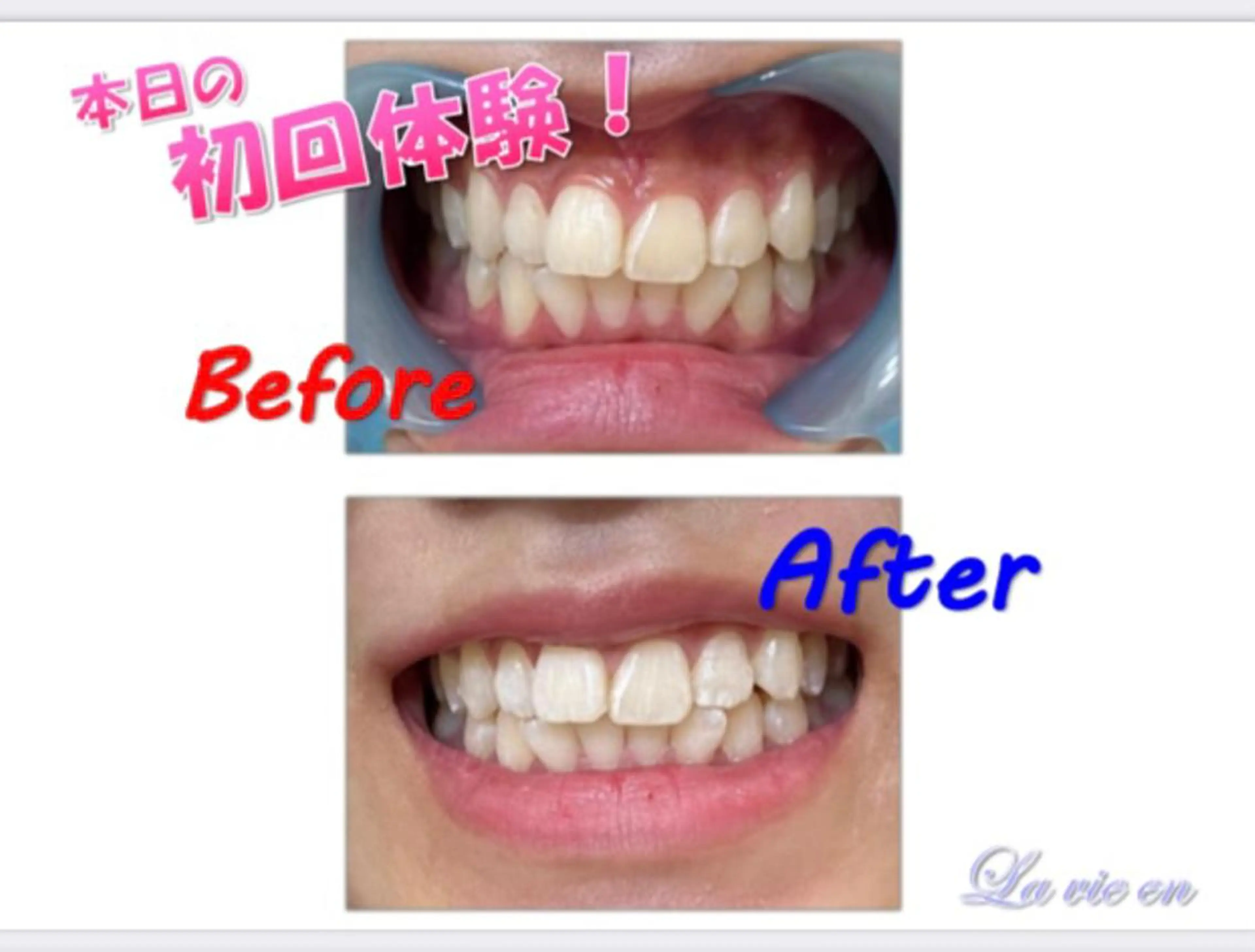 その他 セルフホワイトニングサロン　ラヴィアン所属・ホワイトニングサロン La vie enのその他イメージ