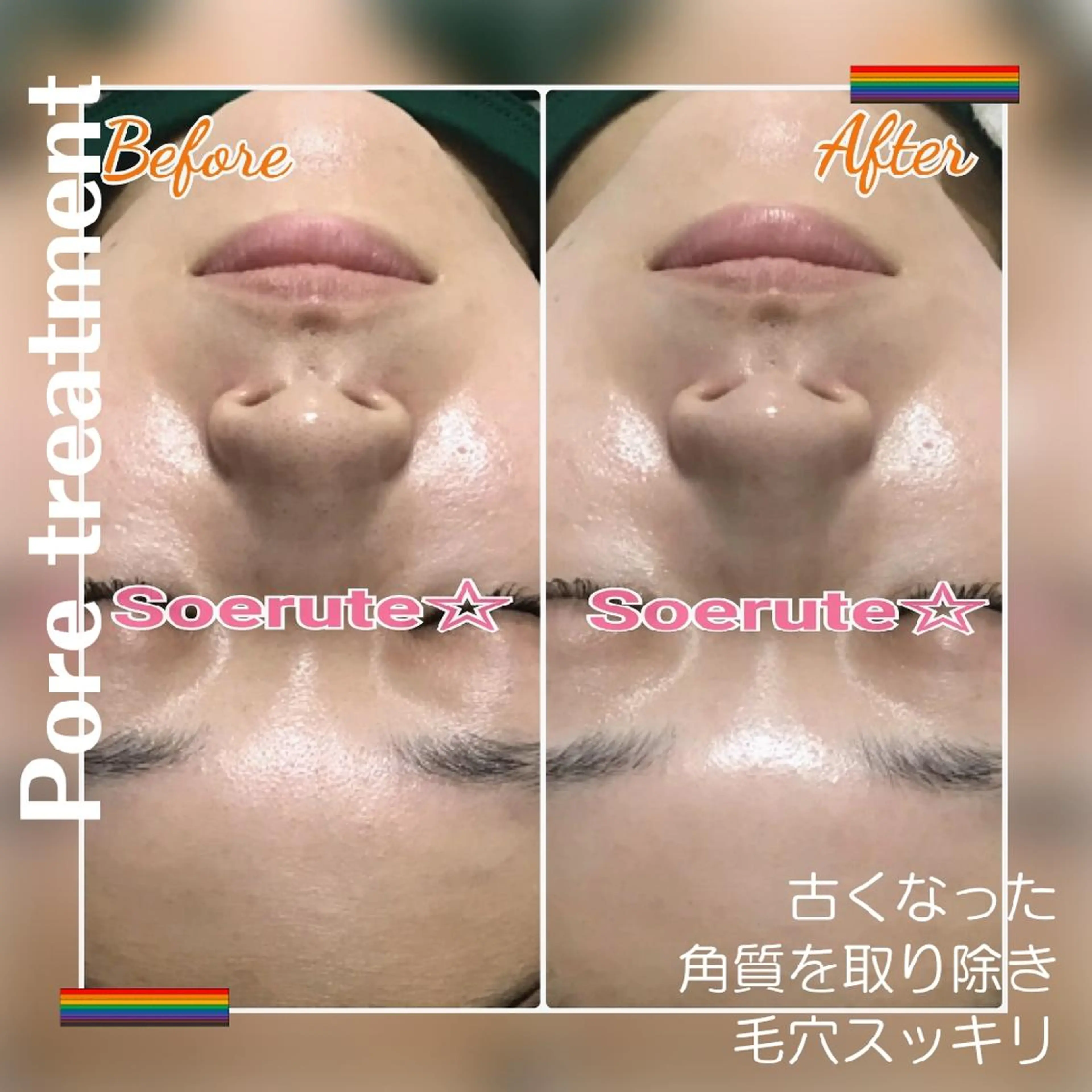 エステ Soerute☆ ソエルテ 井上みえのエステ・リラクイメージ