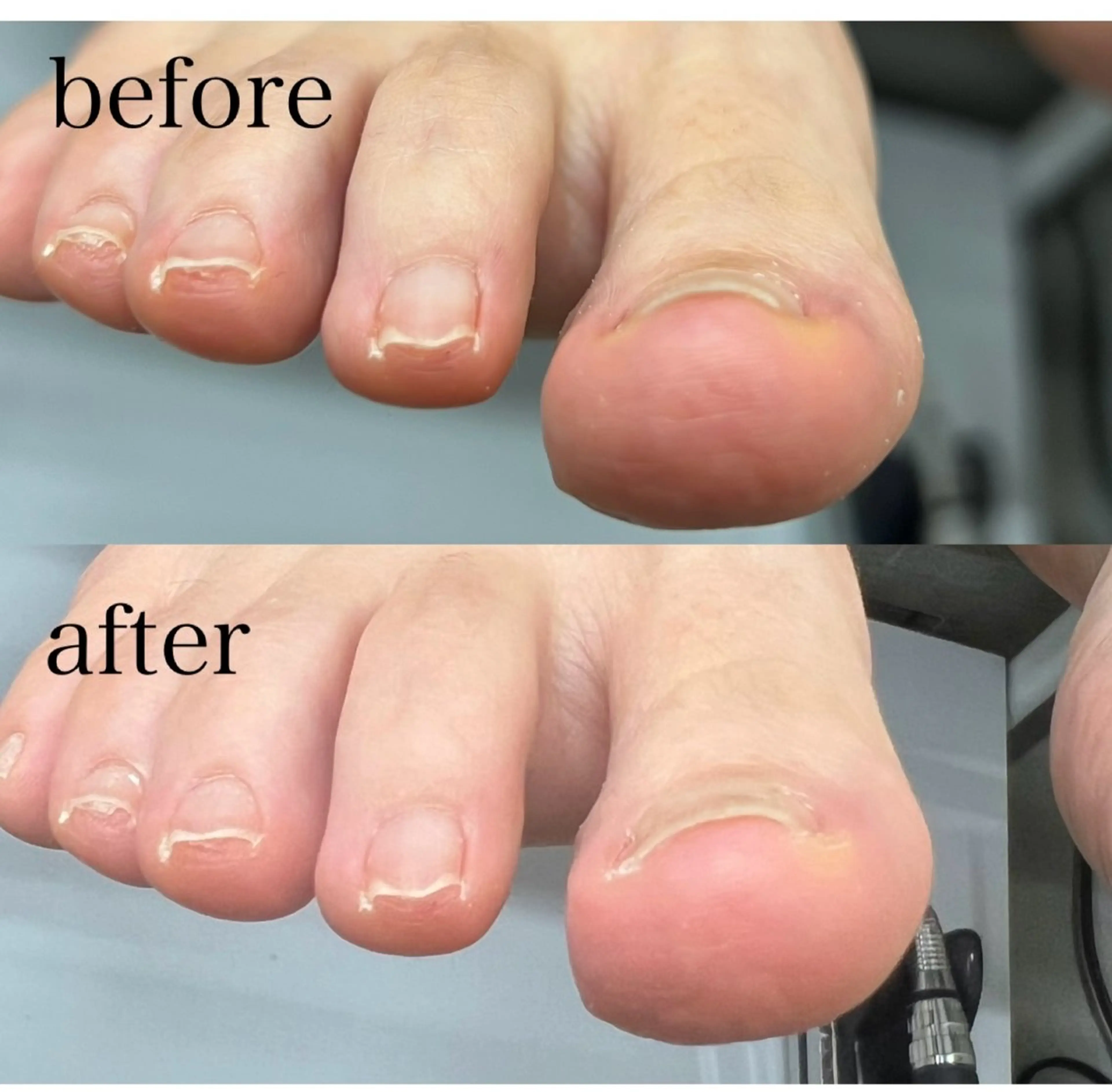 ネイル asuka 🐰のネイルデザイン