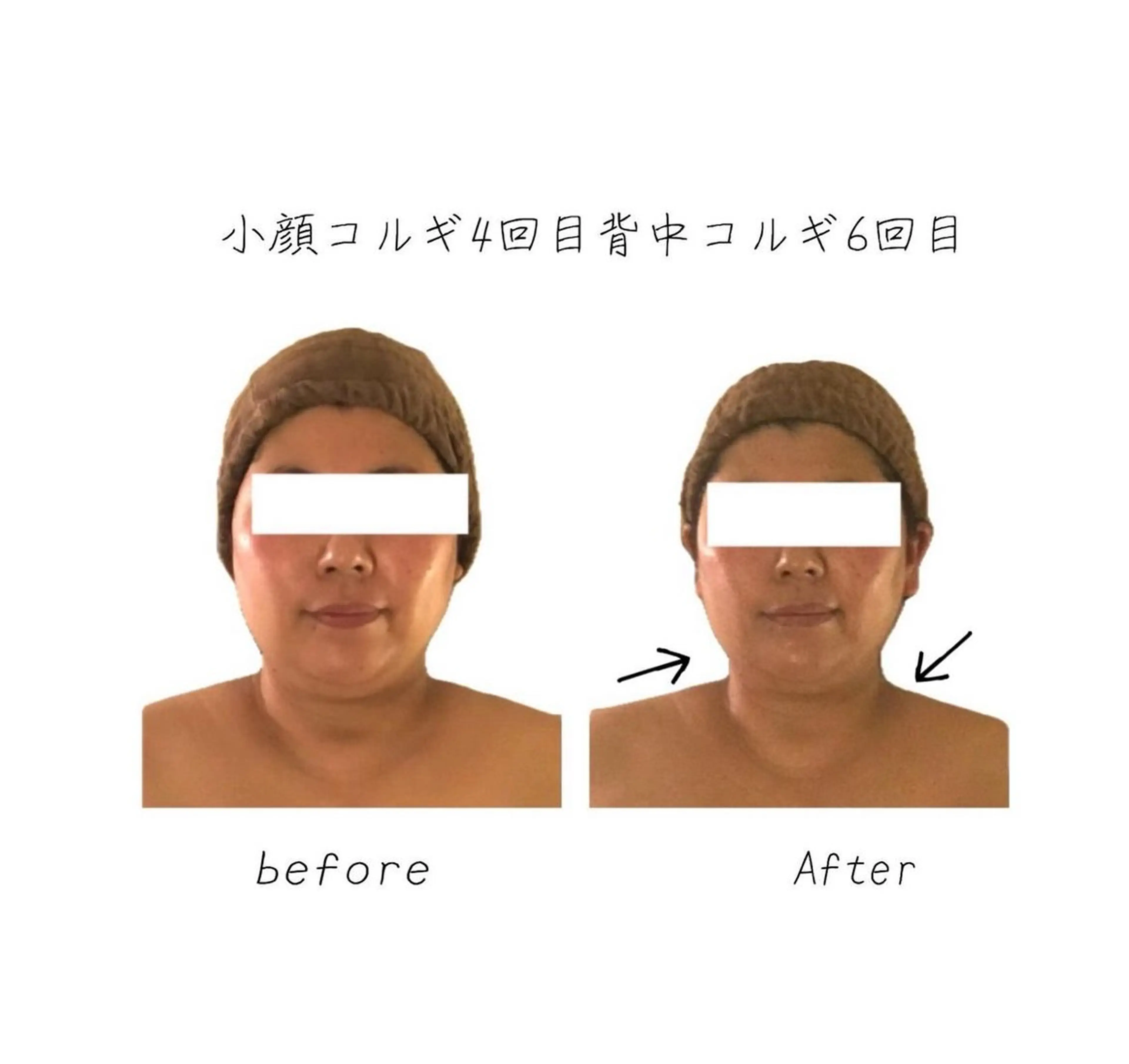 小顔コルギ専門店/隠れ家サロン《여름ヨルム》所属・小顔コルギ専門店 《ヨルム》龍ケ崎店のエステ・リラクイメージ