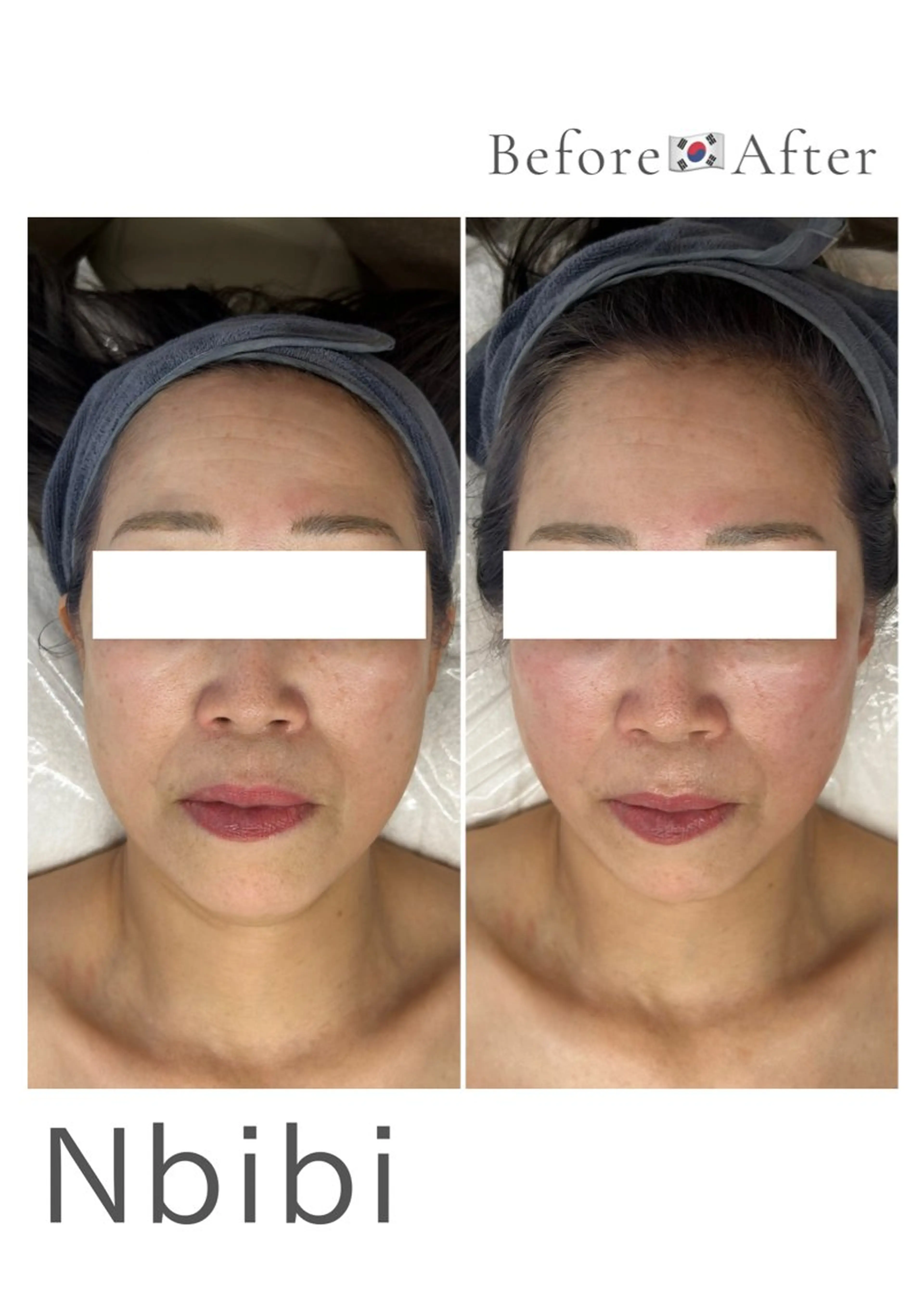 韓国🇰🇷価格 サロン_Nbibiのエステ・リラクイメージ