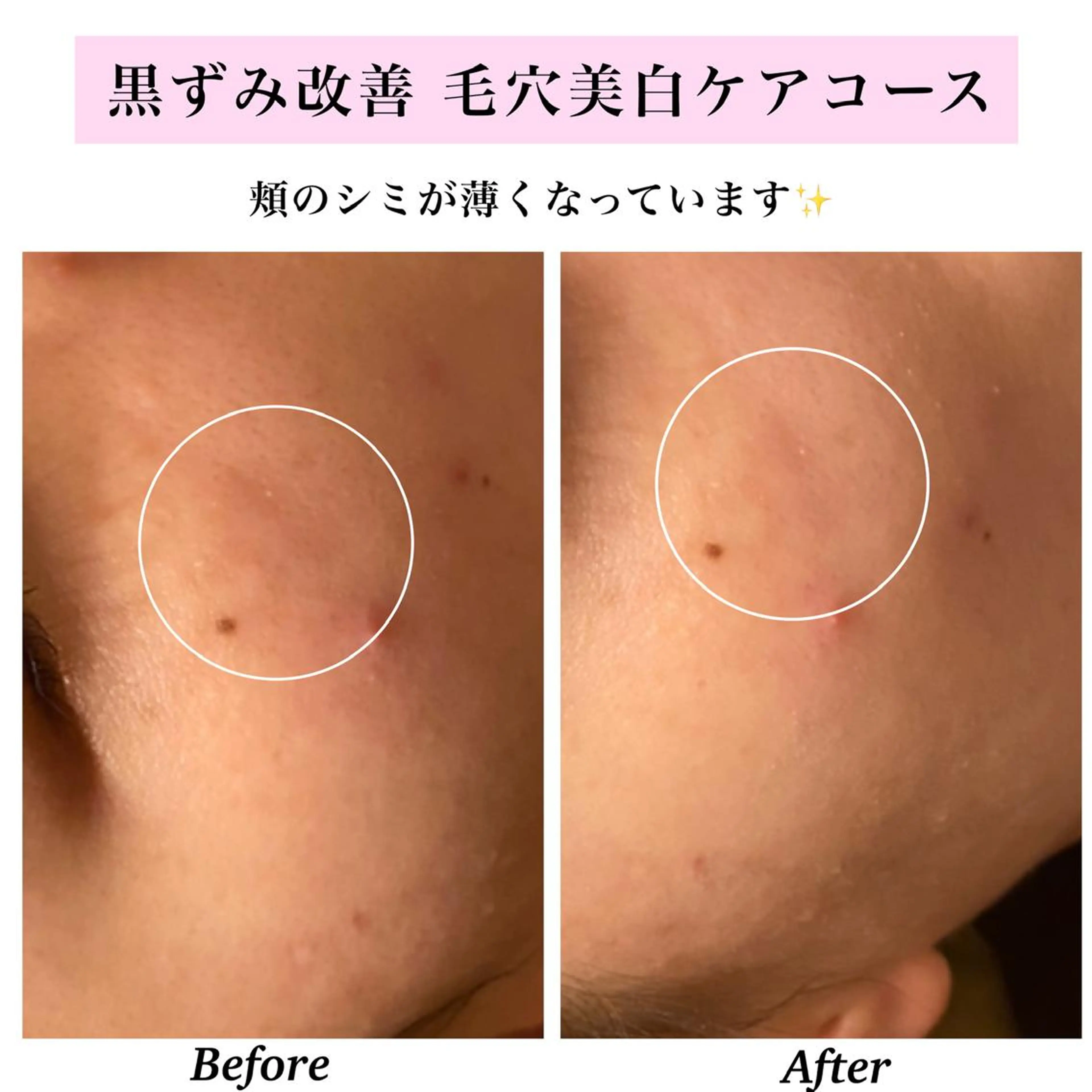 エステ リラク Bellesthe （ベルエステ）のエステ・リラクイメージ