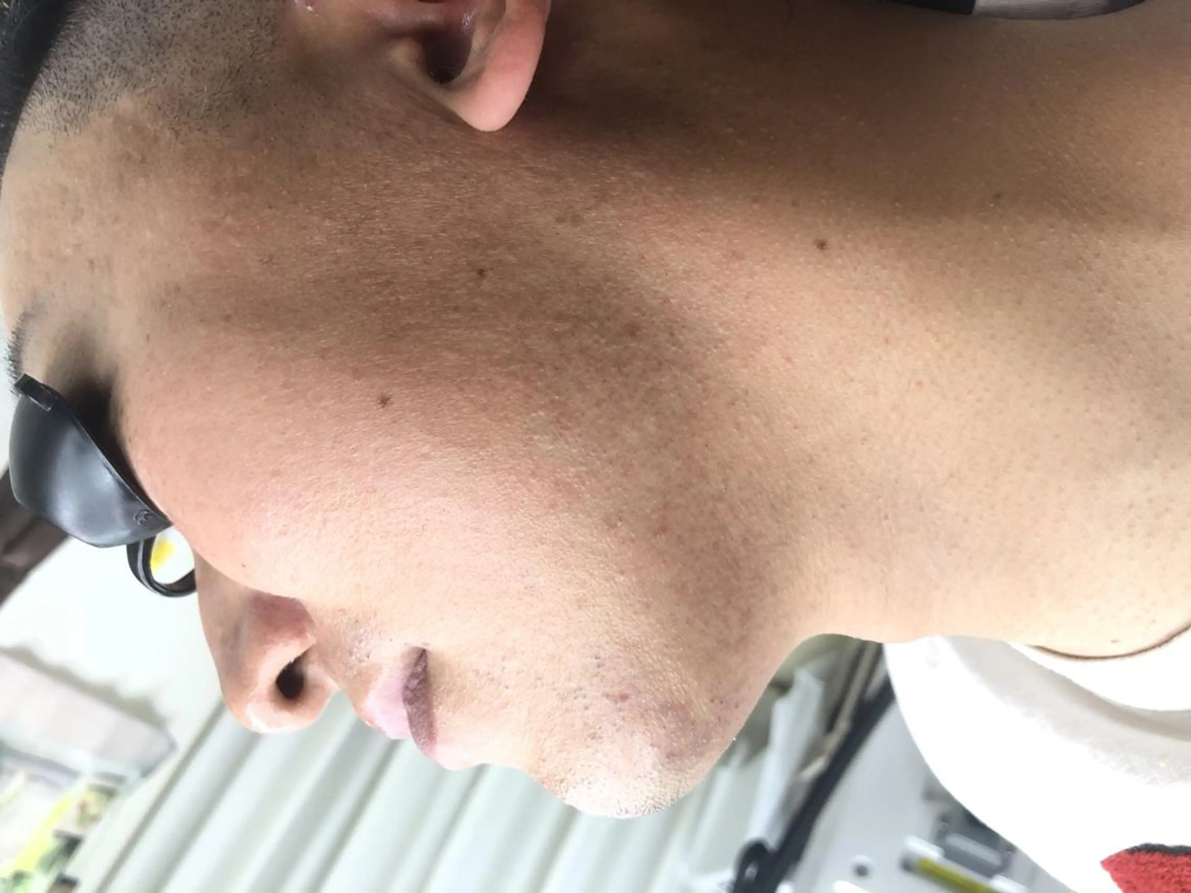 メンズ 脱毛サロン y0uのエステ・リラクイメージ