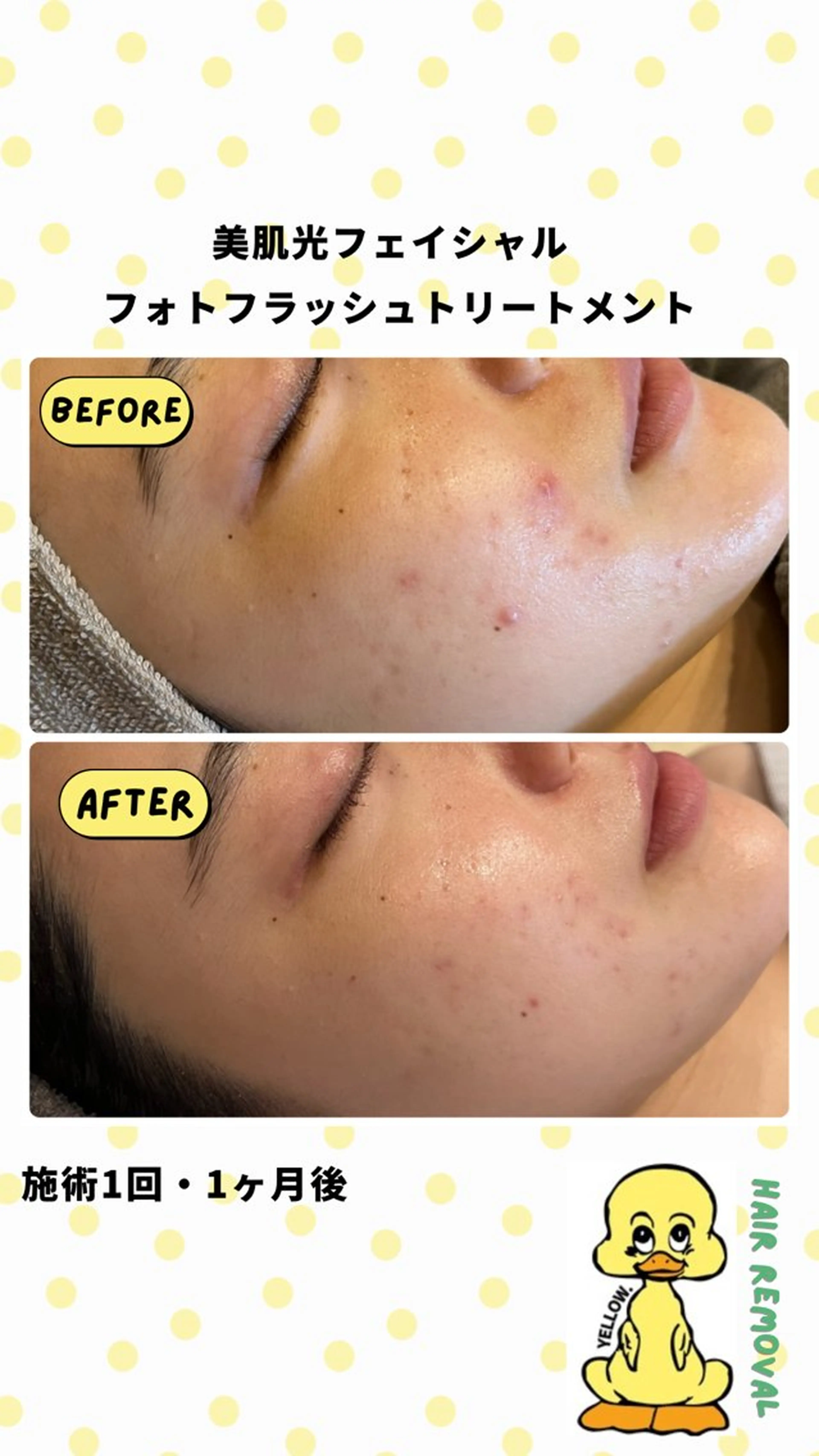 yellow.所属・yellow💛【 脱毛&フェイシャル】のエステ・リラクイメージ
