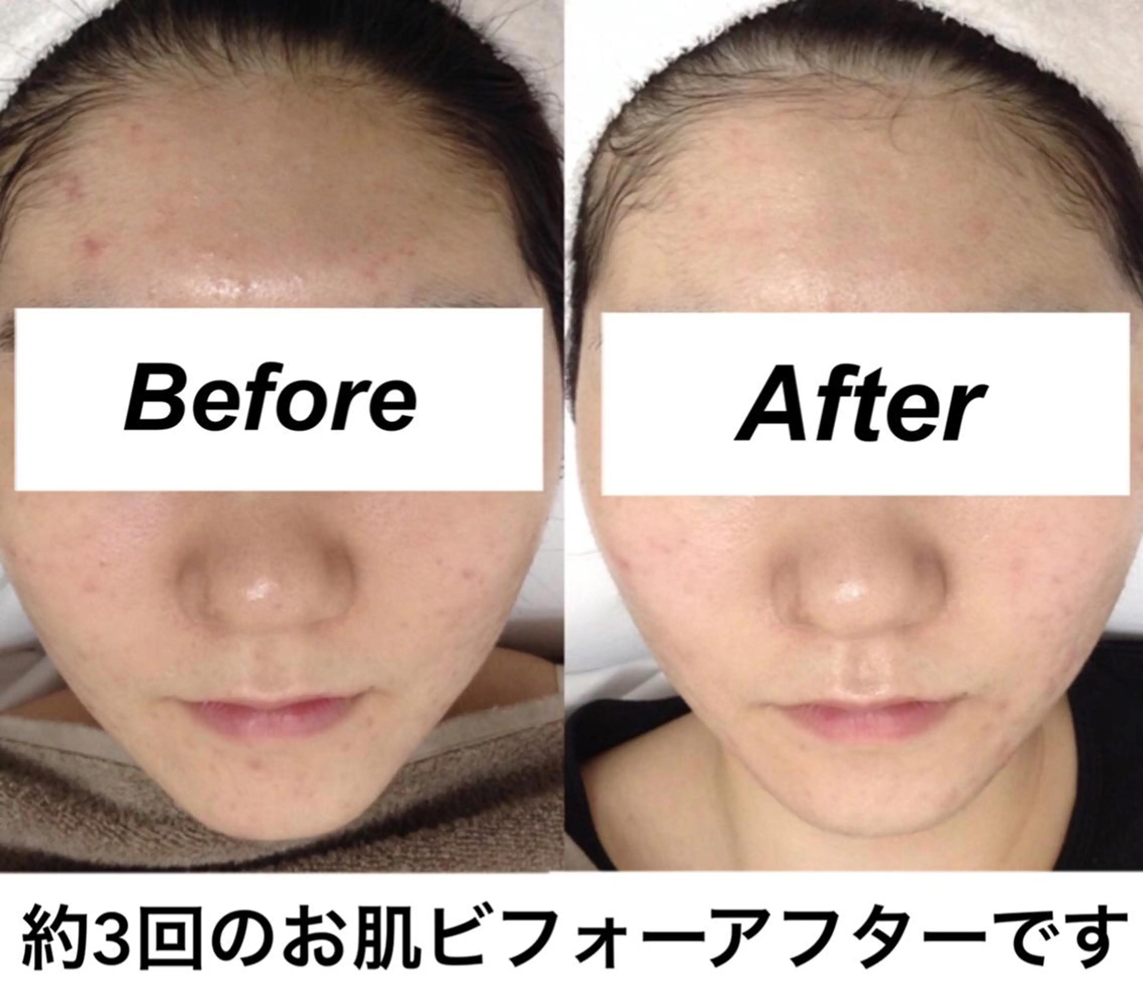 エステ リラク 都度払い肌質改善 &脱毛Blancheのエステ・リラクイメージ