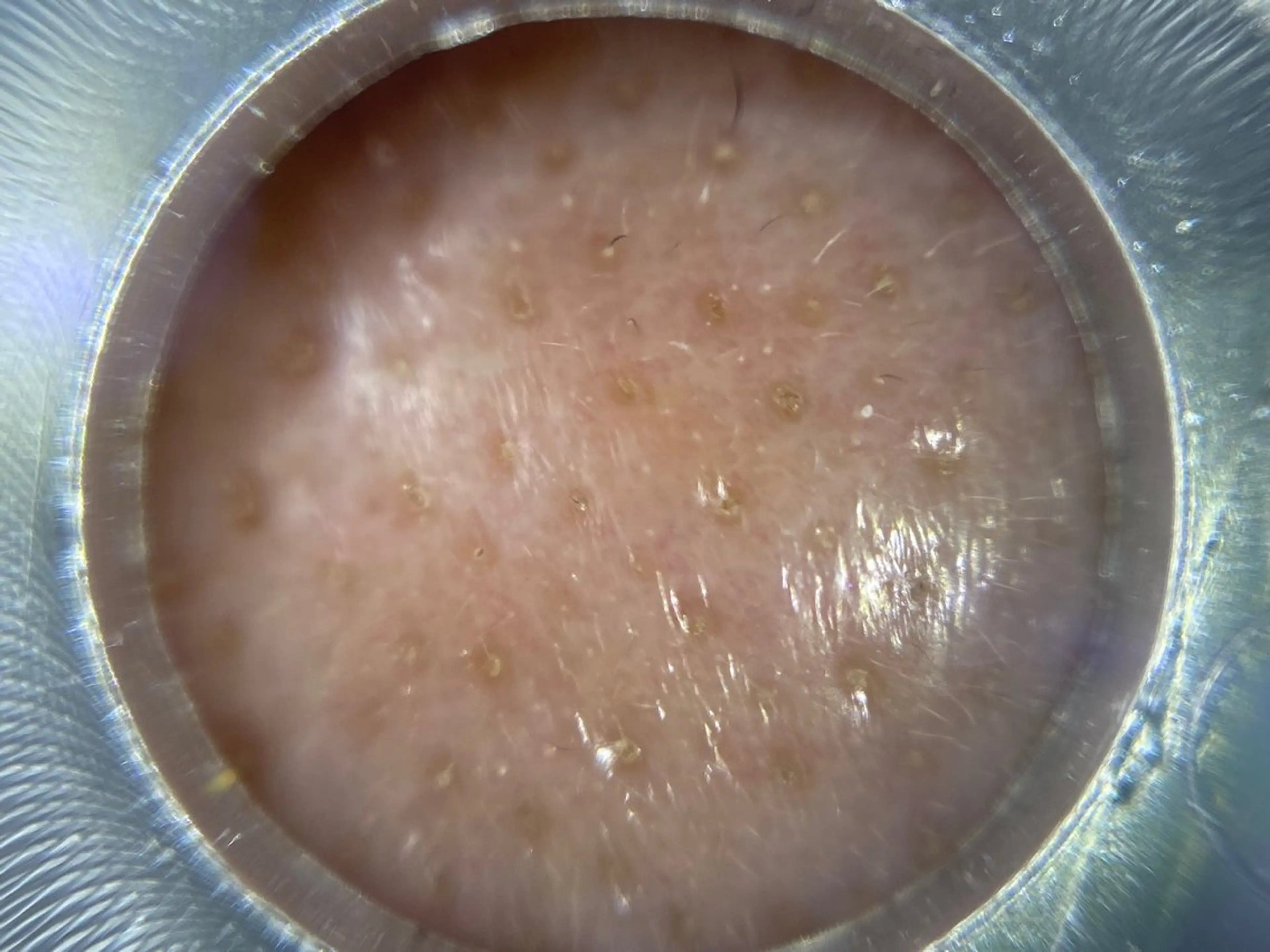 エステ シミケア専門店 &More所属・シミケア専門店 &Moreのエステ・リラクイメージ