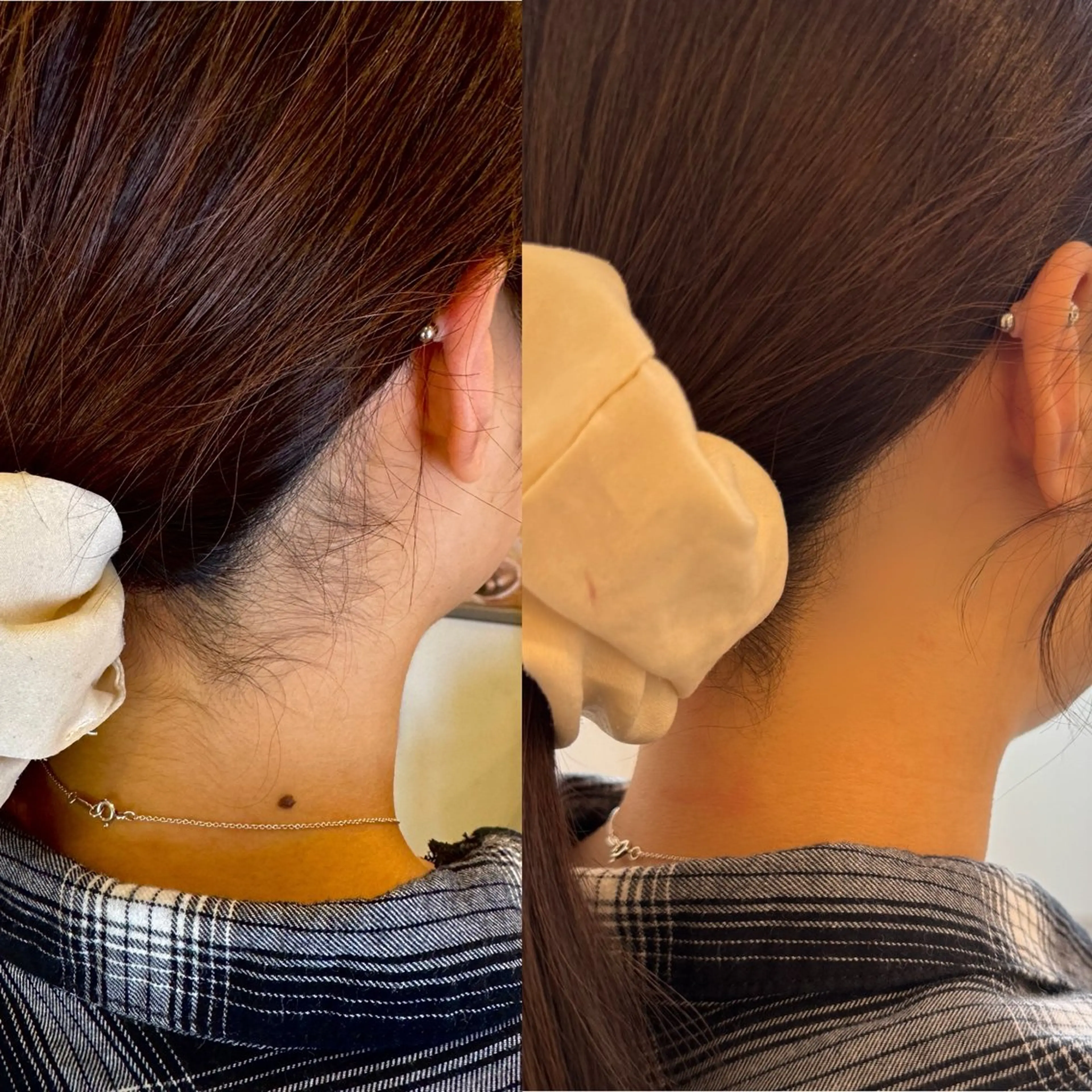 脱毛 茶谷 梨紗のその他イメージ