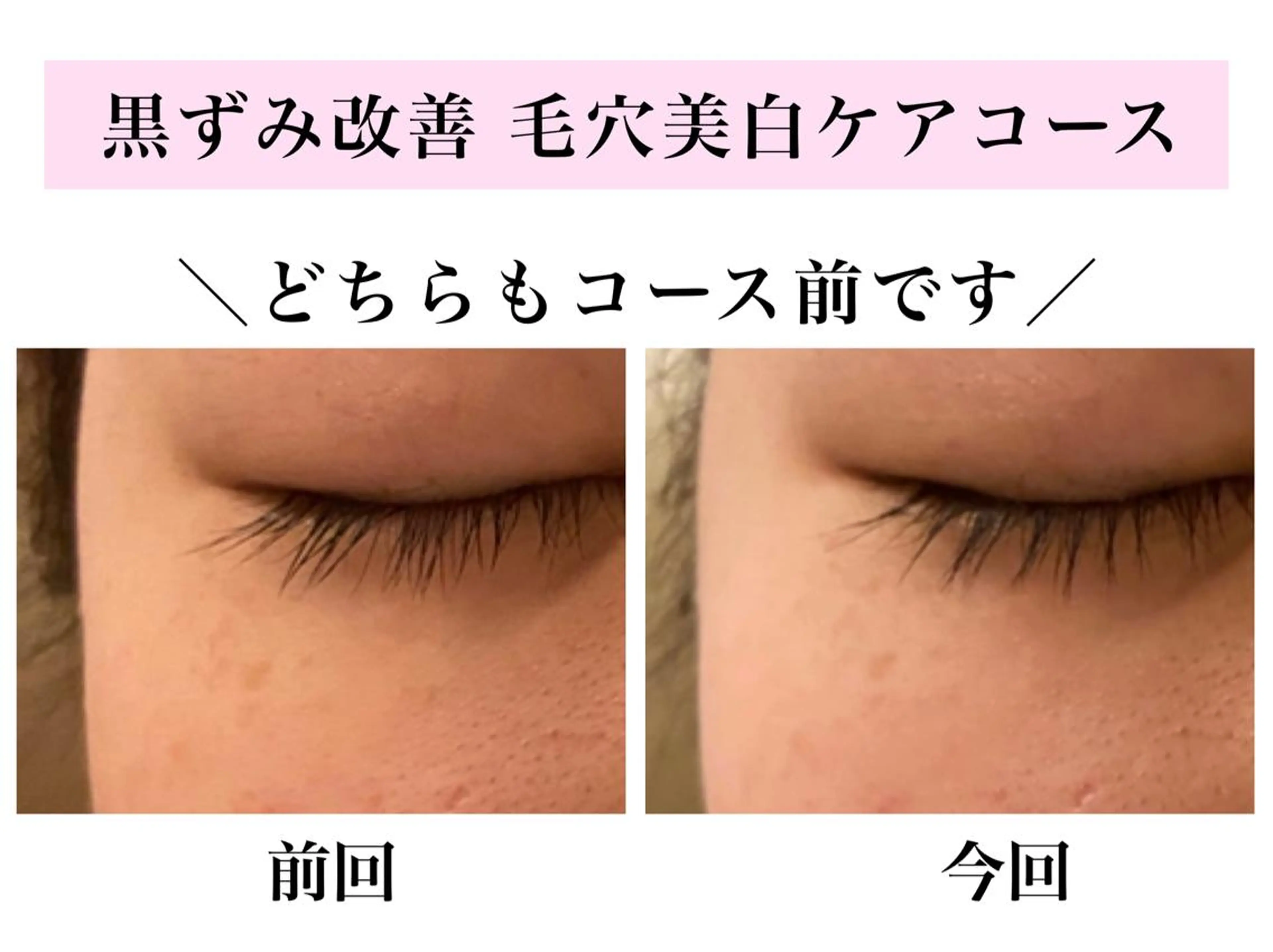 エステ リラク Bellesthe (ベルエステ)のエステ・リラクイメージ