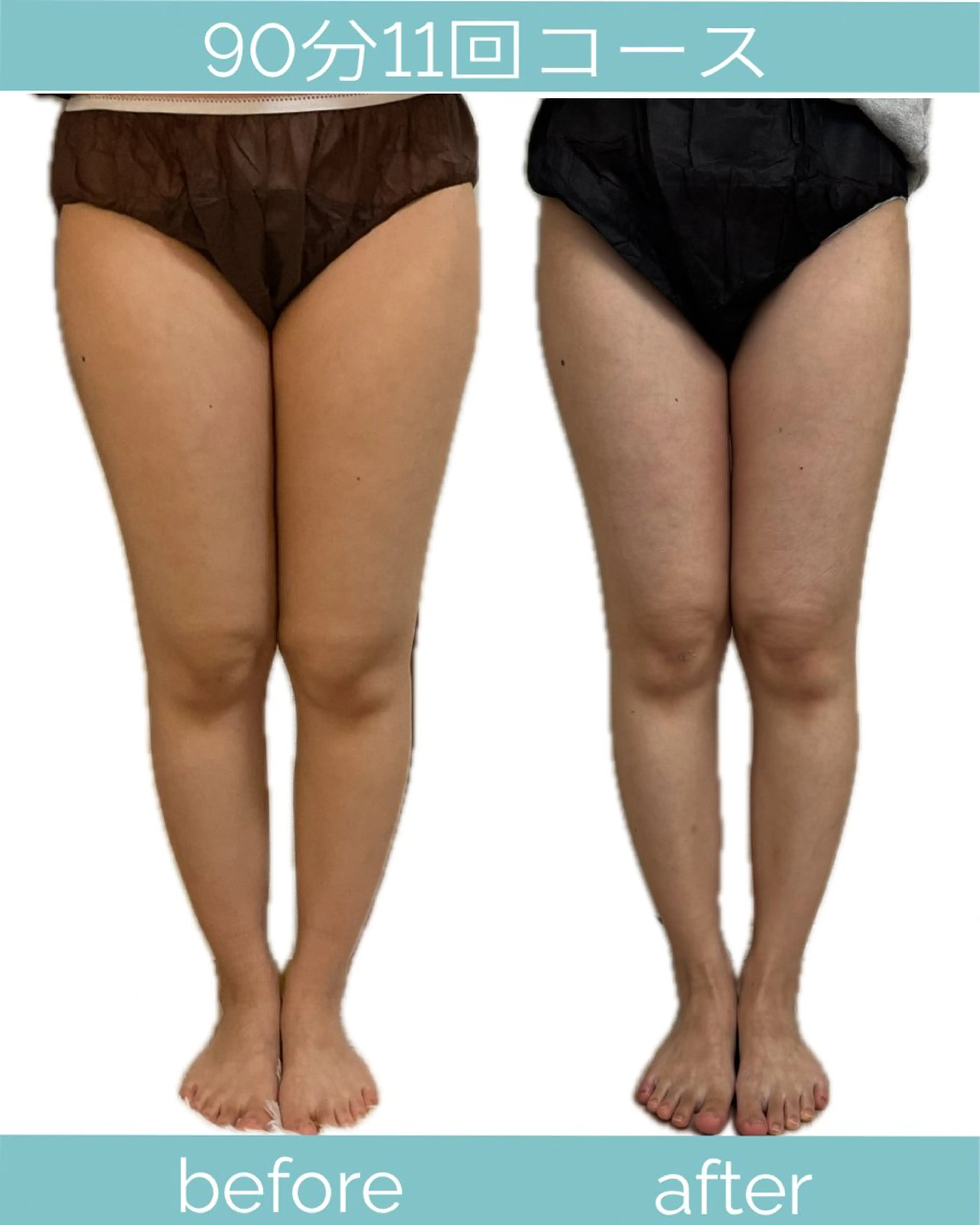 エステ リラク 宮崎 みおのエステ・リラクイメージ