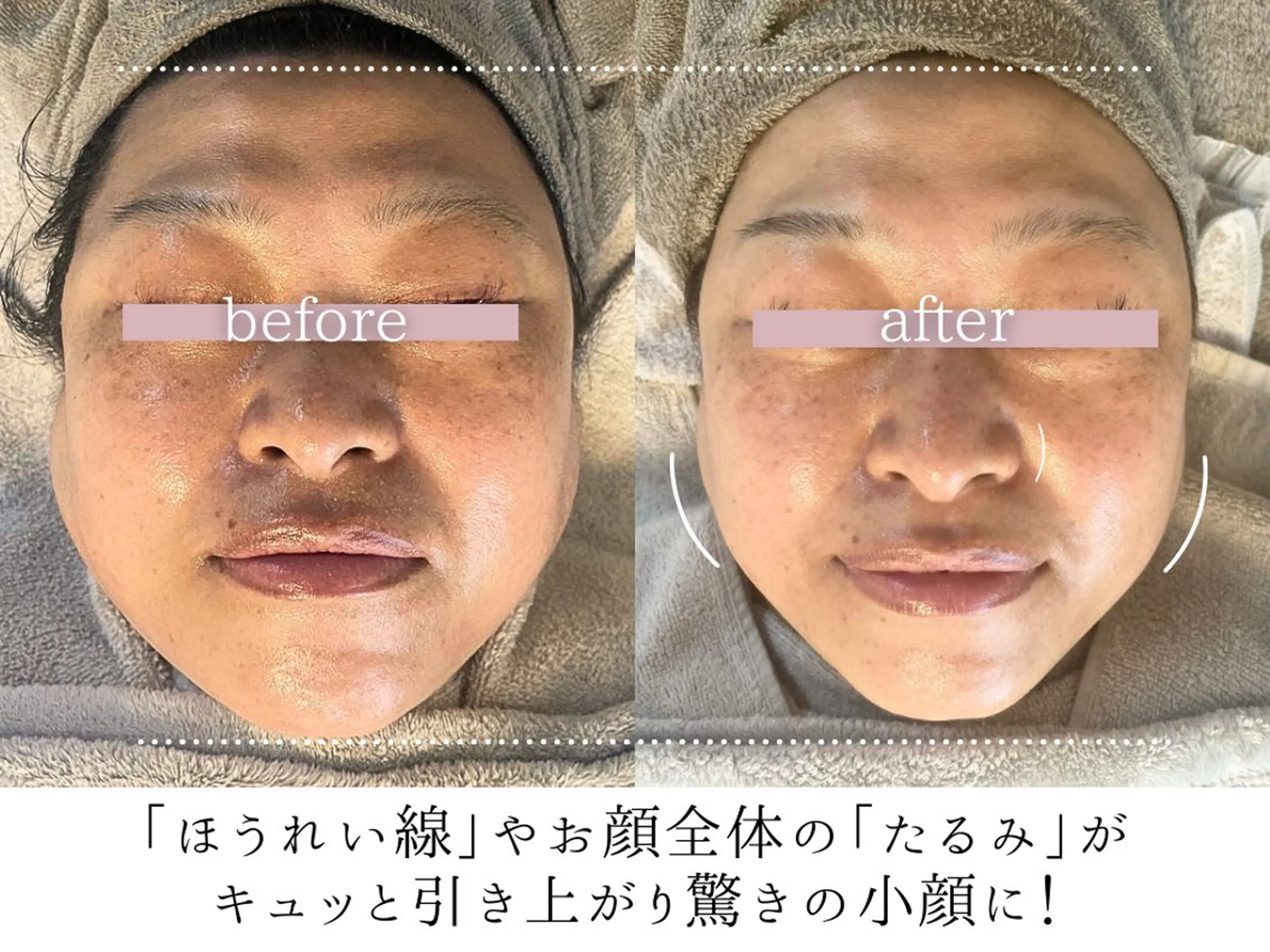 頭蓋骨小顔コルギPerm所属・頭蓋骨小顔コルギ Permのその他イメージ