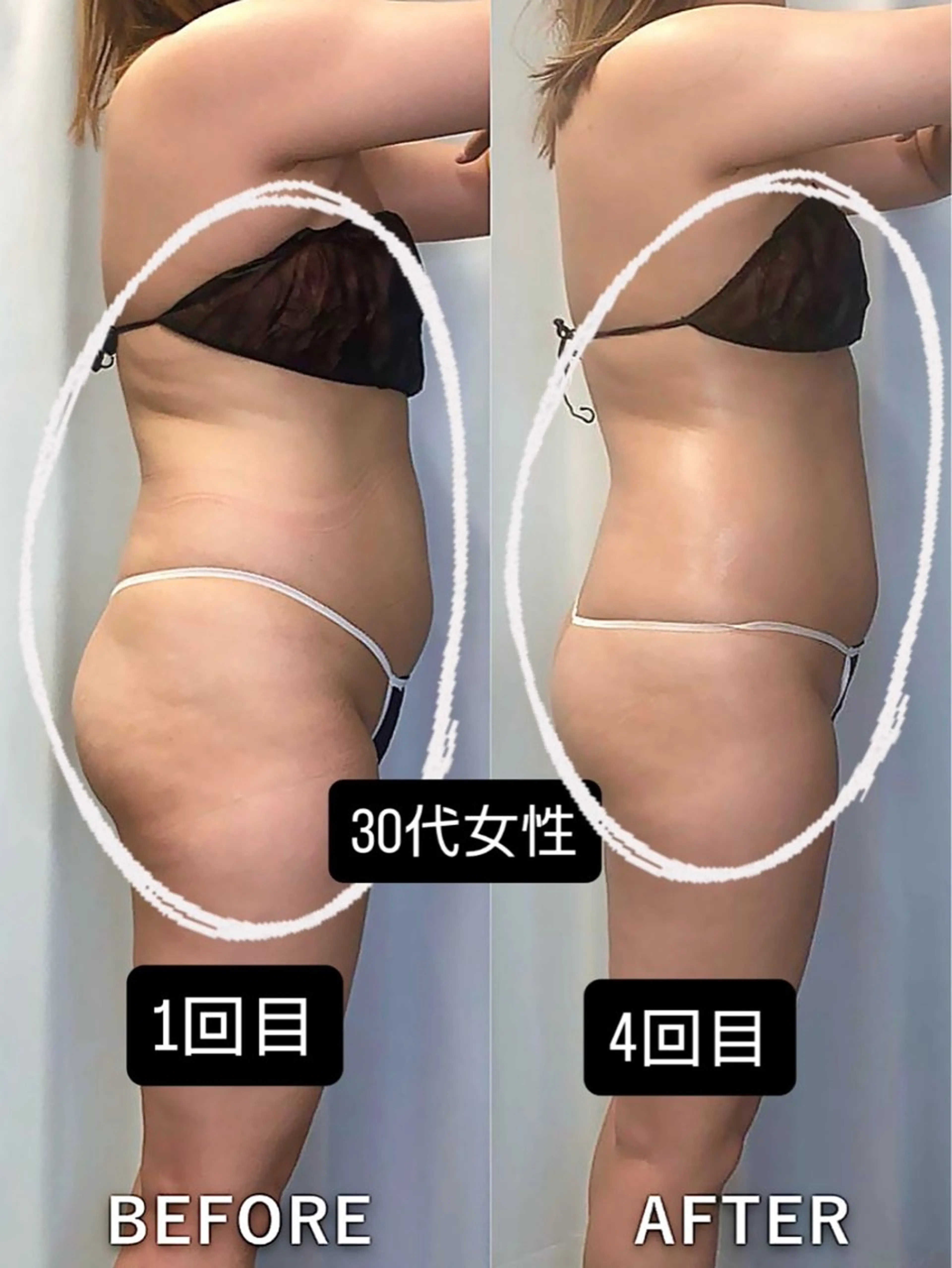 エステ 美容整体・塗る漢方・フェイシャルRechica所属・心斎橋痩身 美容整体×肌管理のエステ・リラクイメージ