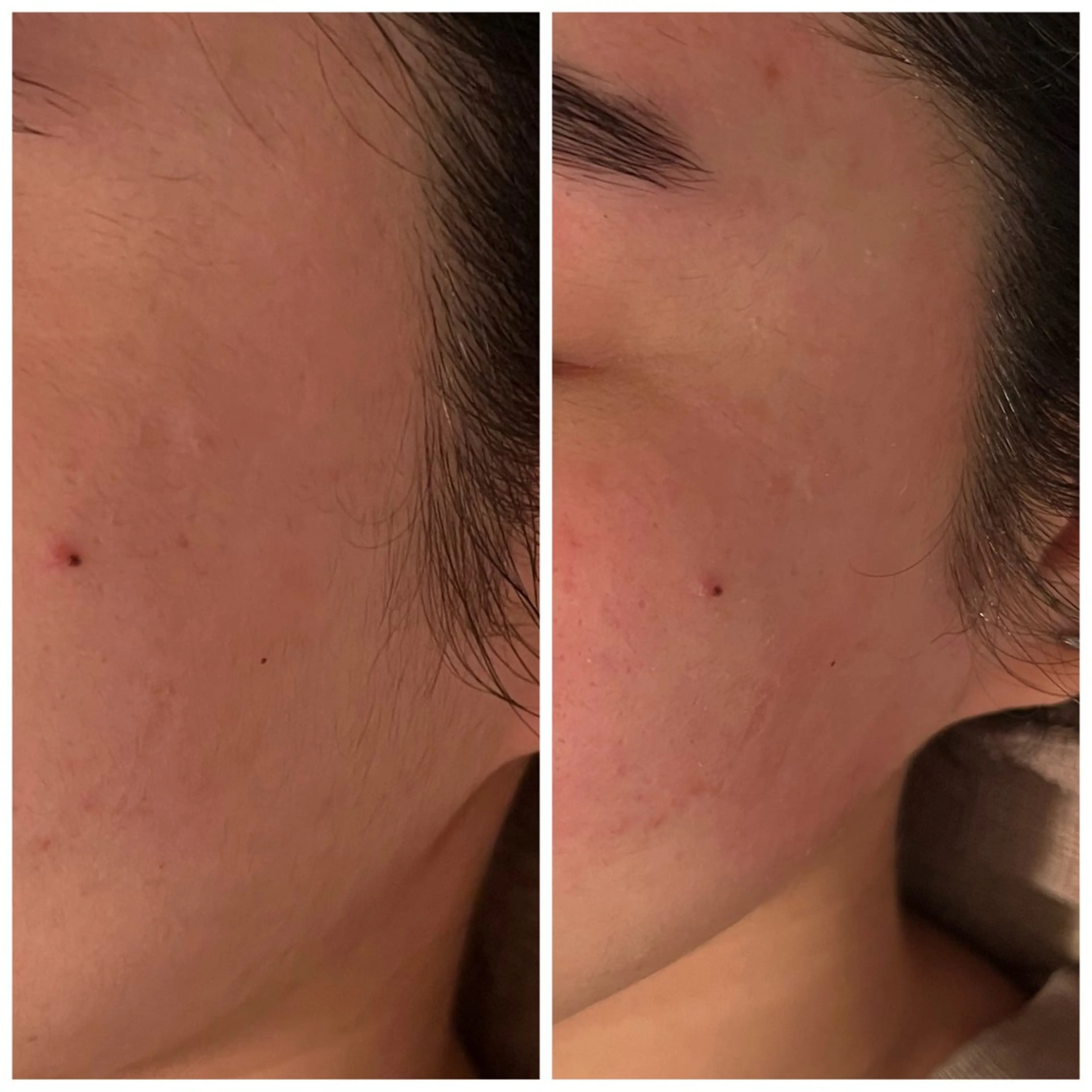 脱毛 B&H所属・頭痛•肩こり専門/ 眉サロンB&H心斎橋のエステ・リラクイメージ