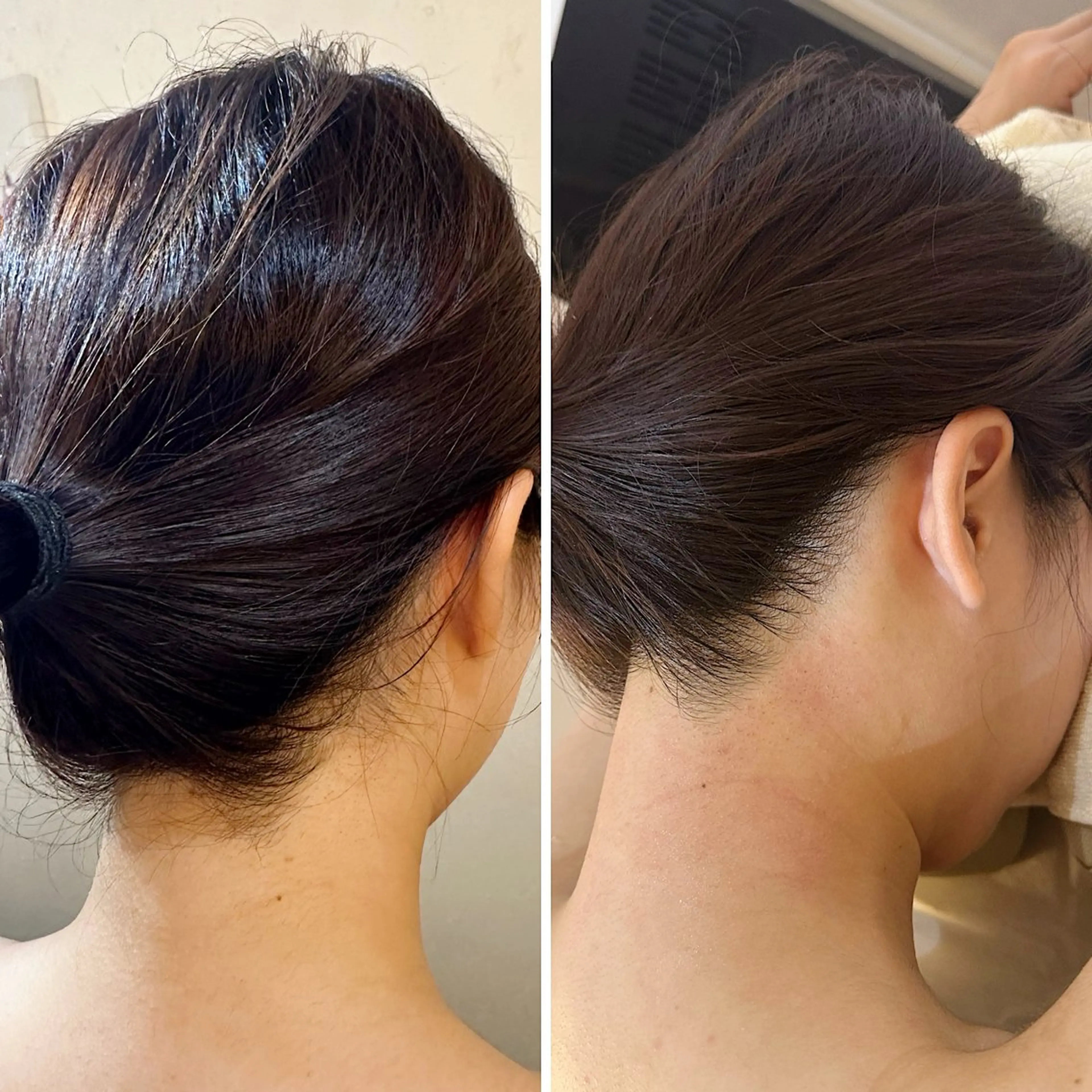 脱毛 うなじ脱毛/美肌脱毛 LABELのエステ・リラクイメージ