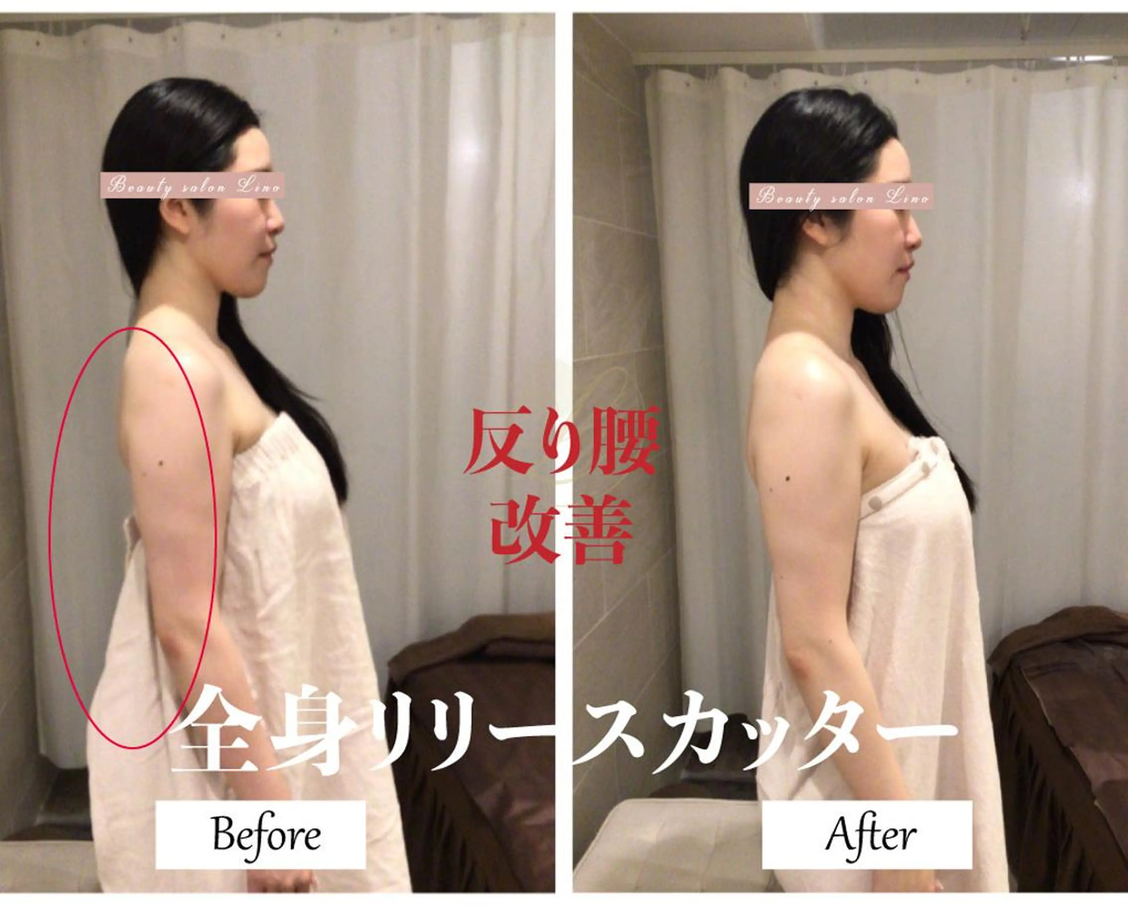 【50分・姿勢改善コース】即効性あり！巻き肩・猫背・反り腰を心地よいマッサージで改善◎ブライダルも👗の写真