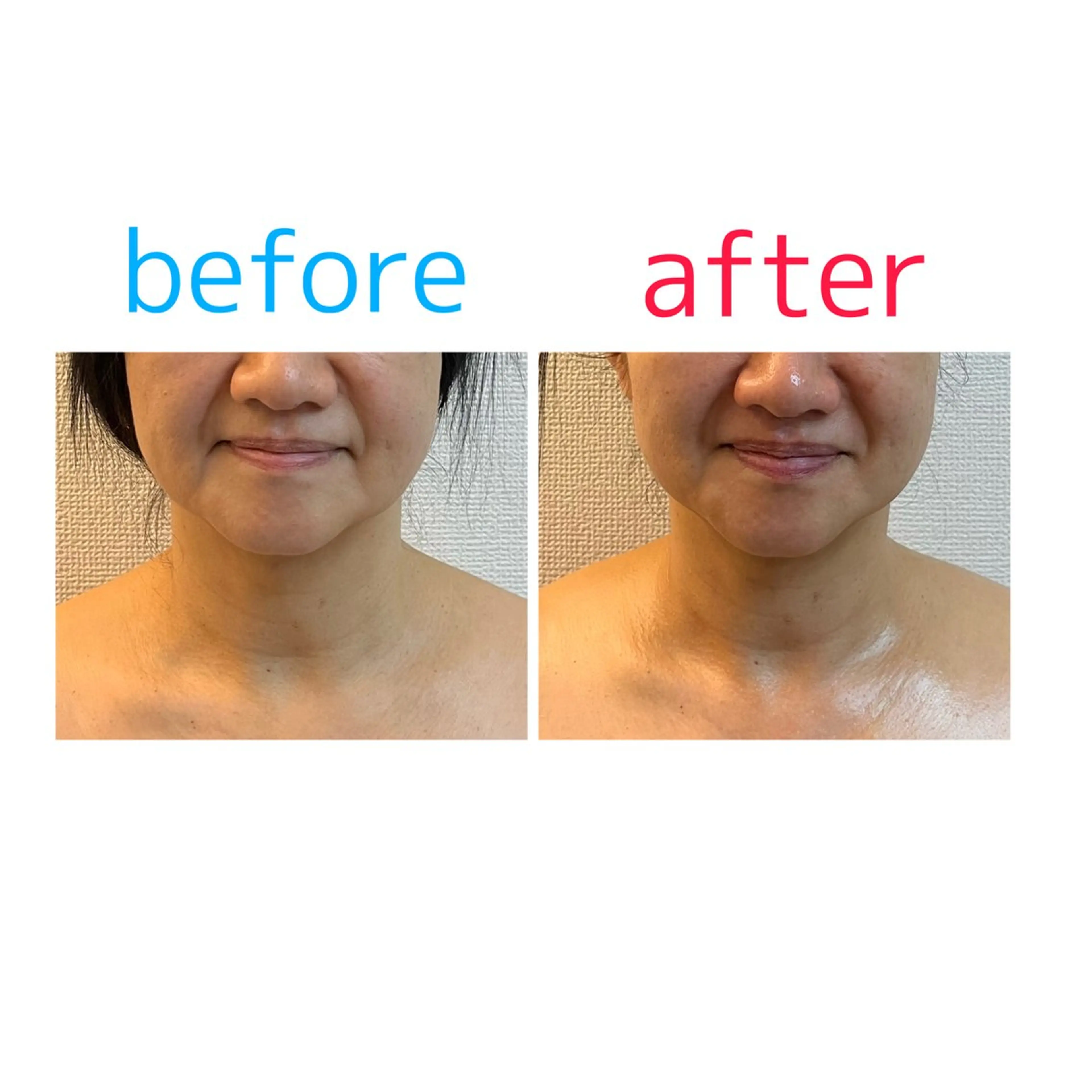 韓国式フェイシャルサロンanela所属・水田 早紀のその他イメージ