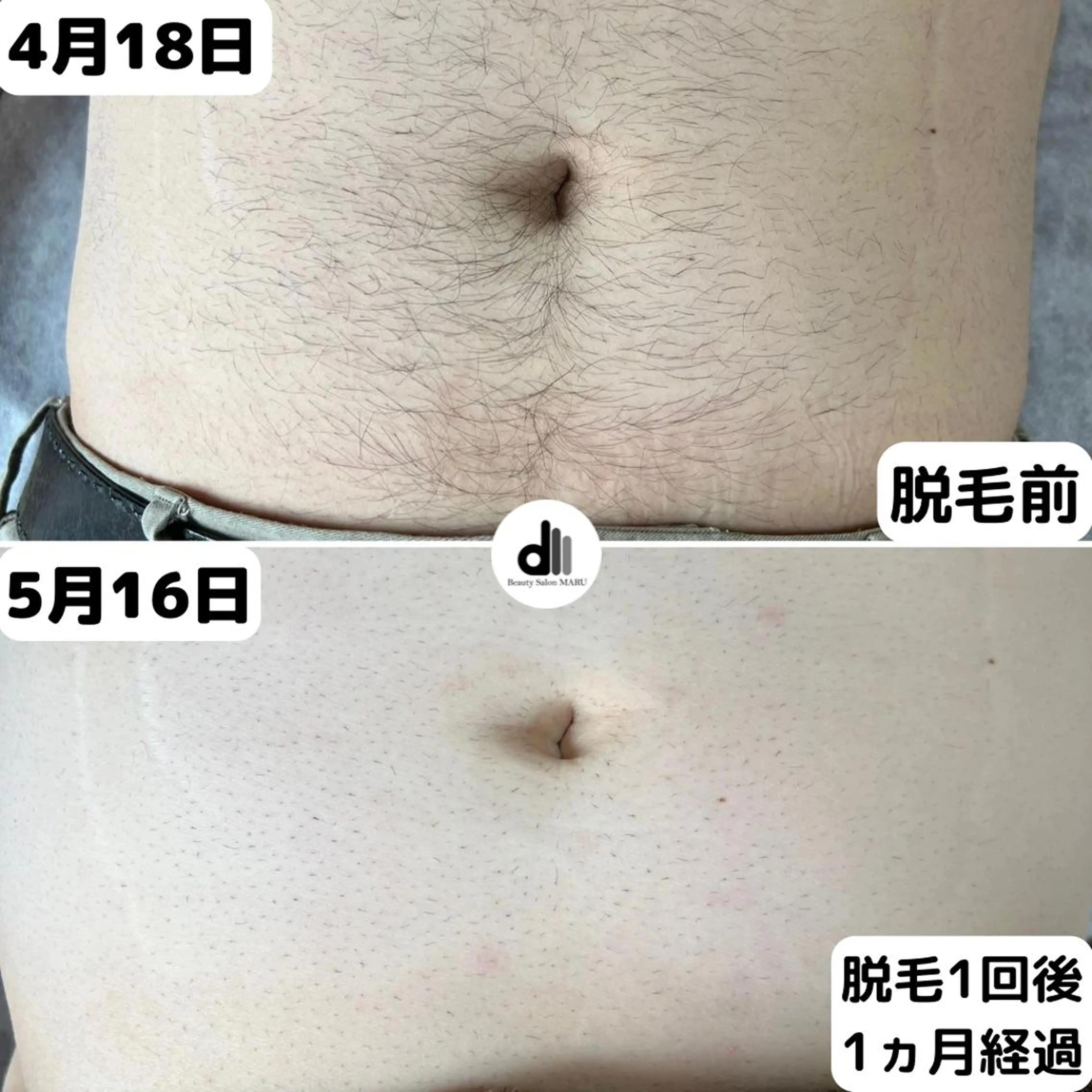 メンズ Beauty Salon MARU所属・新潟市メンズ【脱毛】 MARUのエステ・リラクイメージ