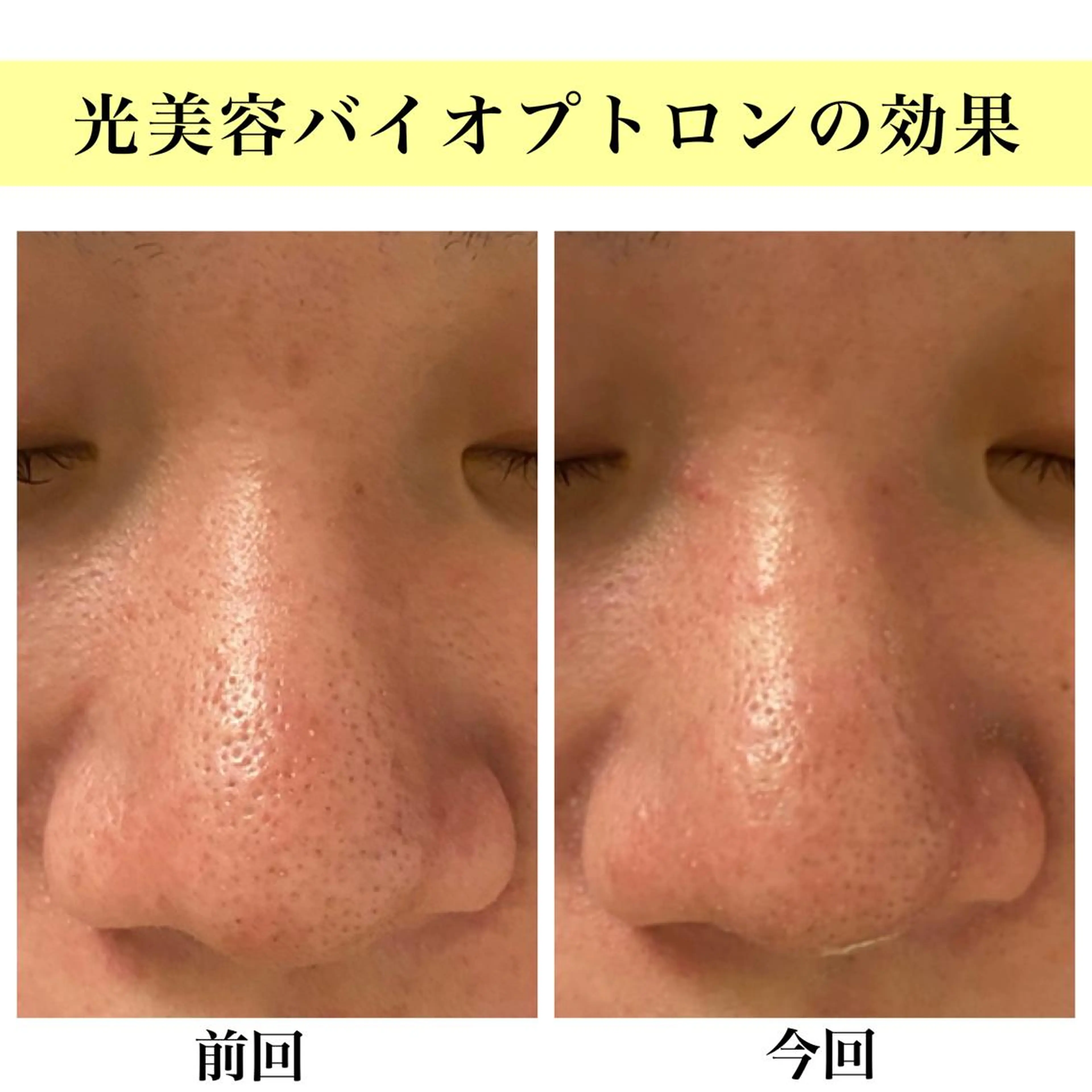 エステ Bellesthe （ベルエステ）のエステ・リラクイメージ