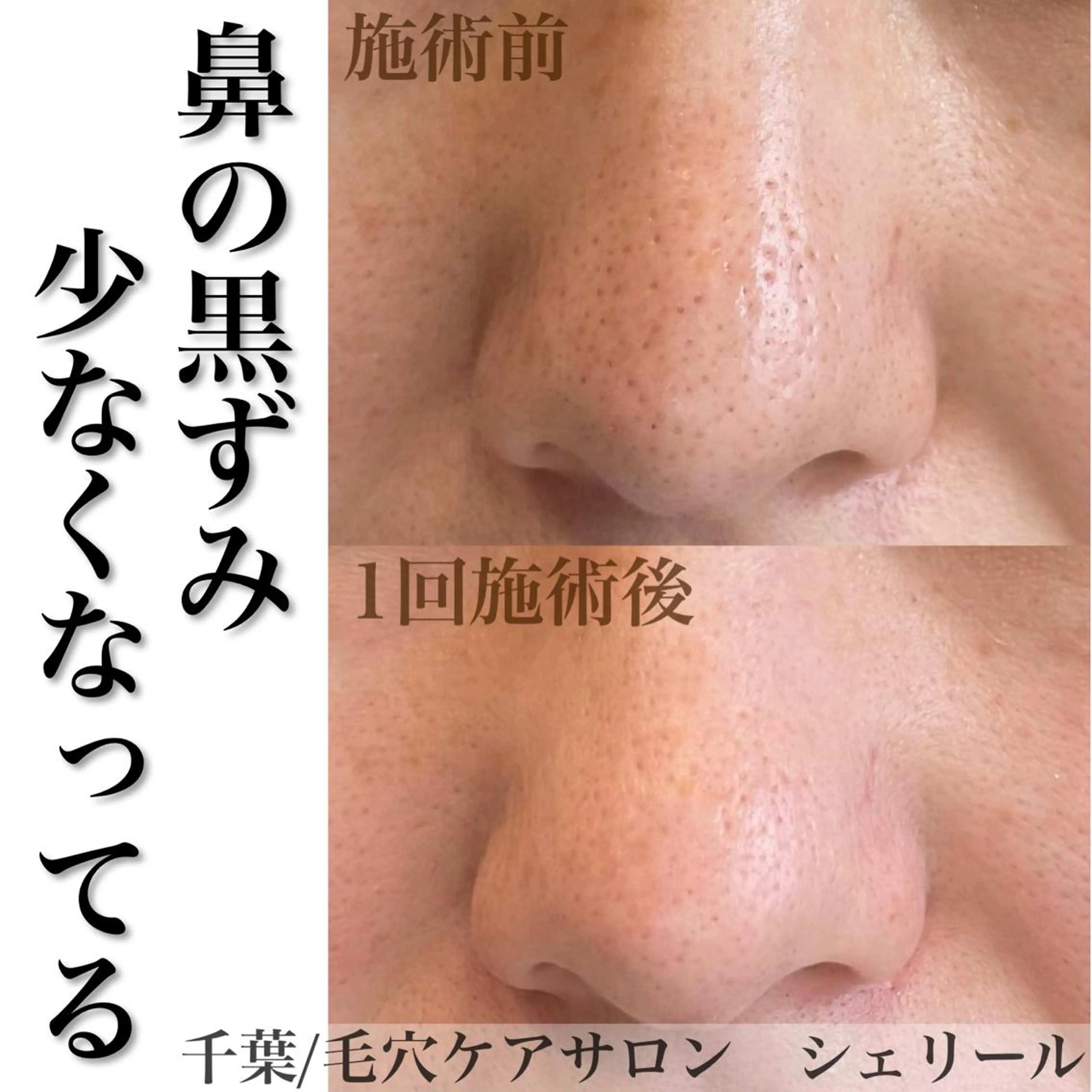 シェリール✳︎ Erinaのマツエク・マツパデザイン