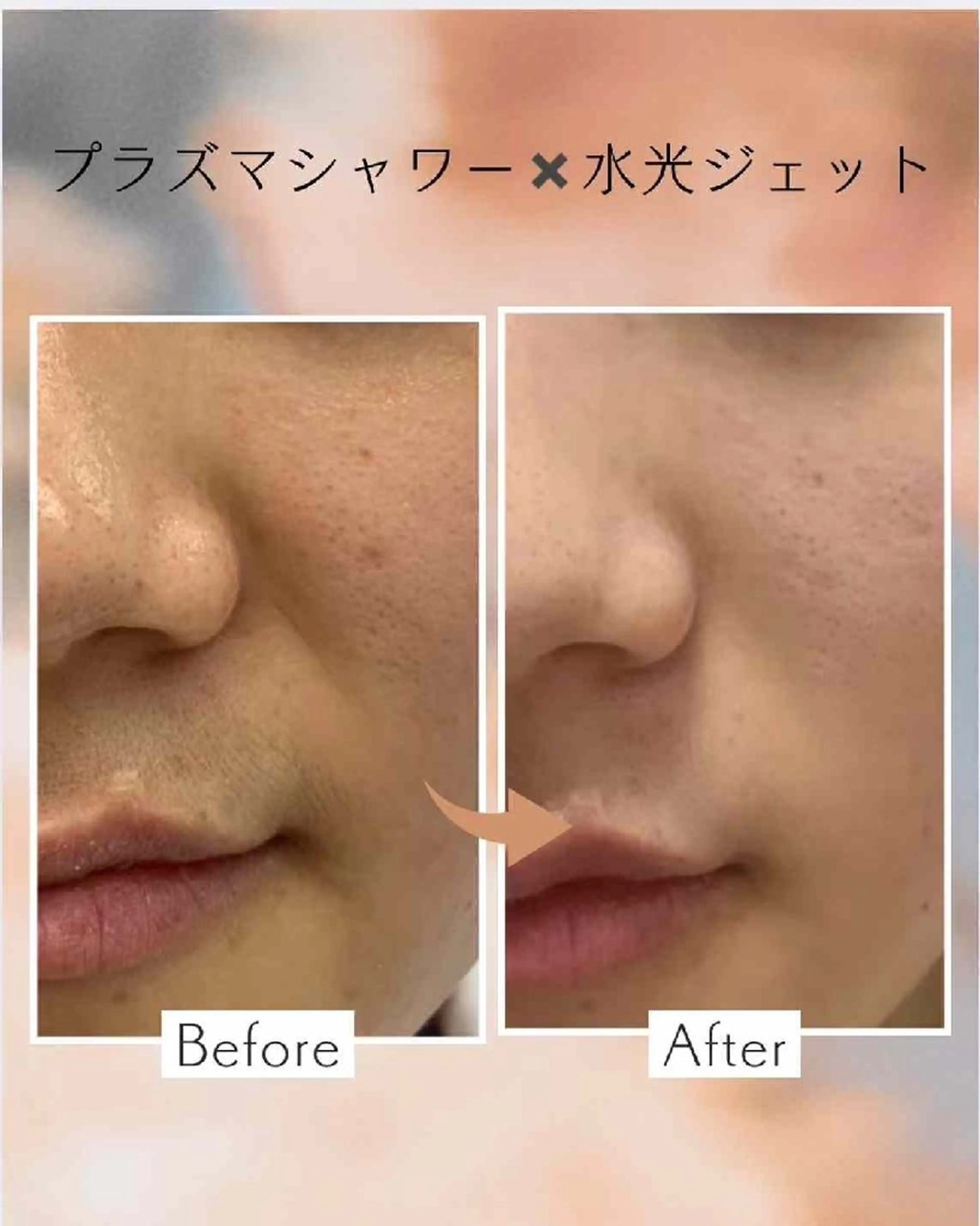 アイブロウ 眉毛ワックス脱毛 aliaハイフ&水光ジェットサロン所属・aliaハーブ水光店 エステティシャン募集のエステ・リラクイメージ