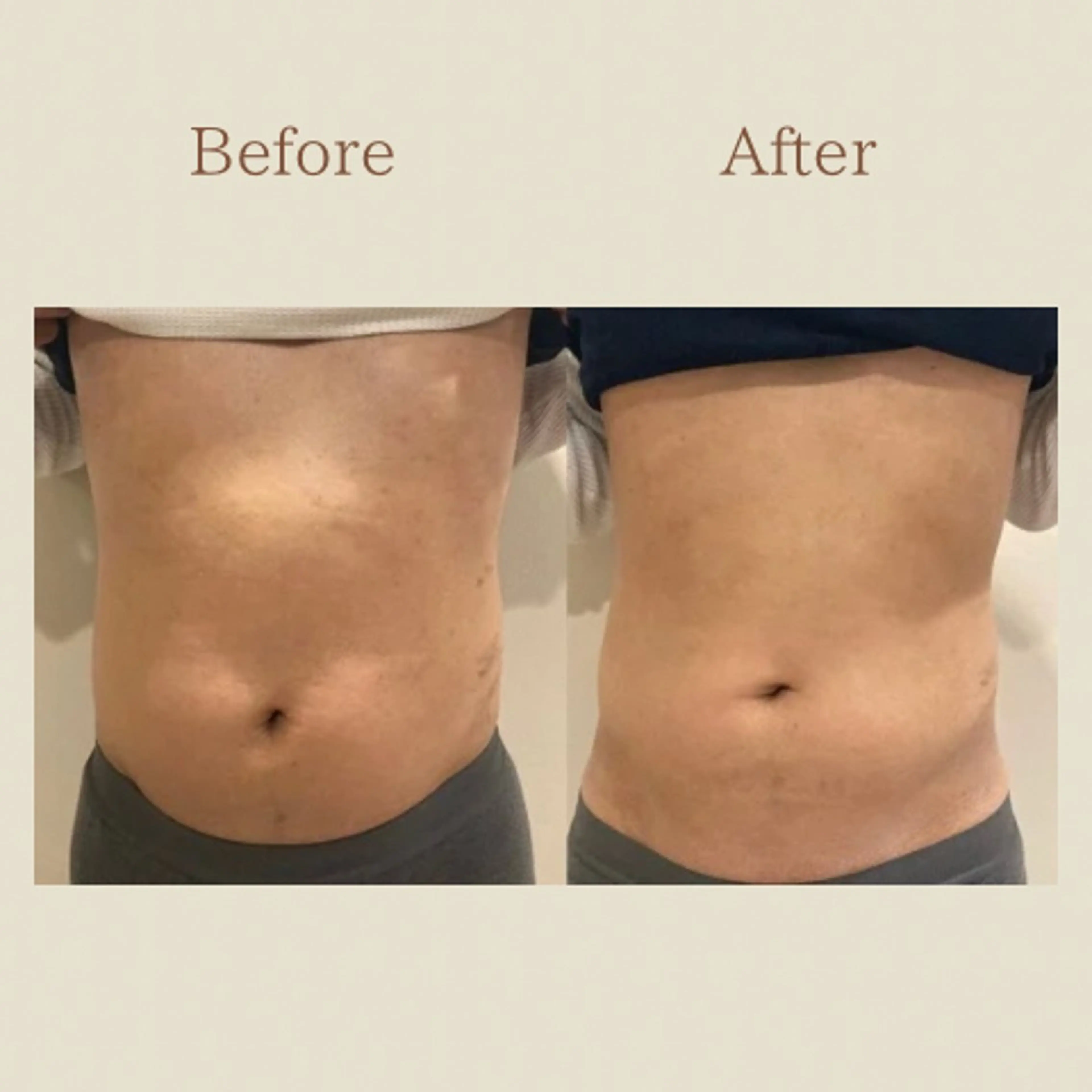 お腹痩せエステ Flat BELLY 恵比寿所属・【腸もみ/脂肪冷却】 お腹エステ/恵比寿のエステ・リラクイメージ