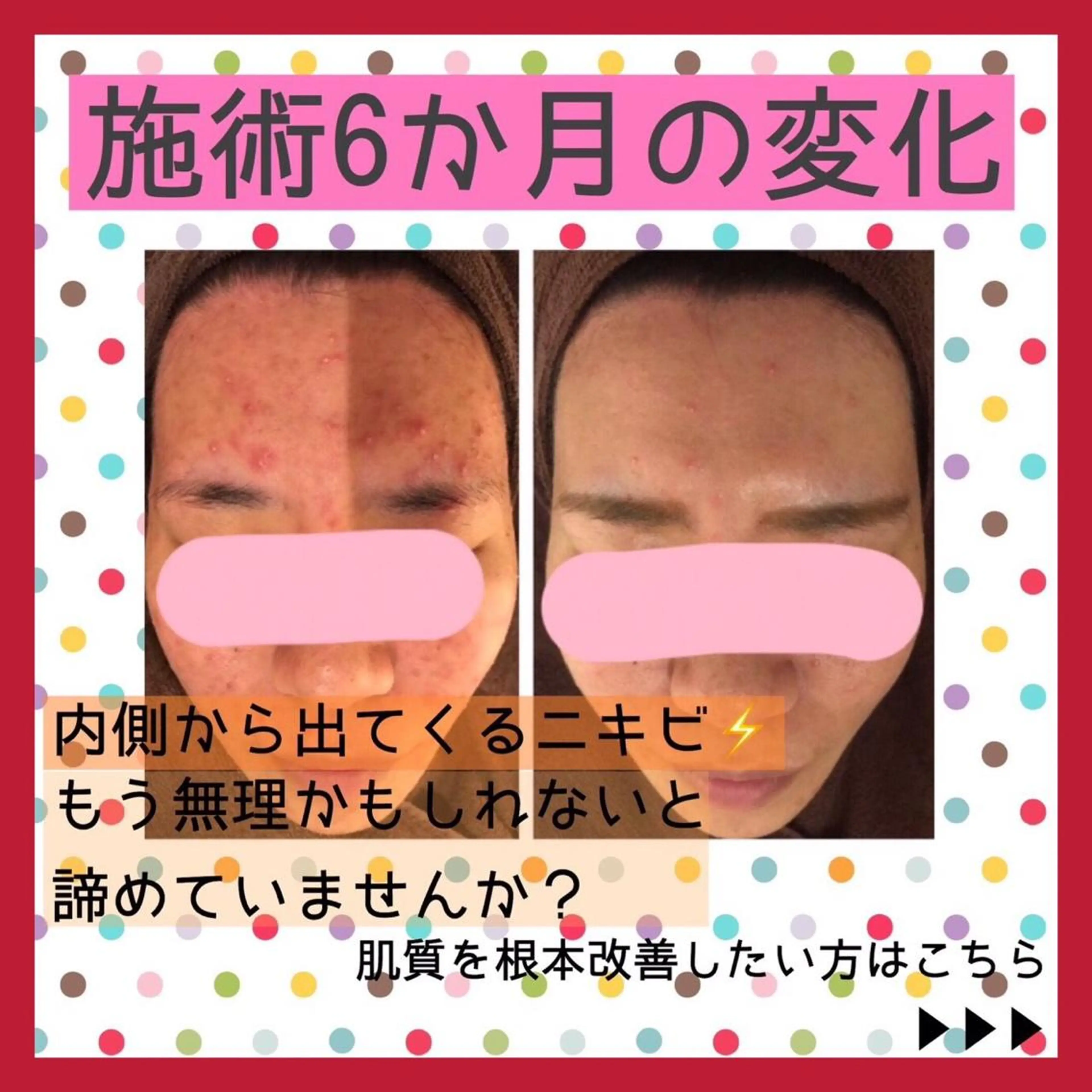 ミディアム カラー パーマ ヘアアレンジ メンズ キッズ ネイル マツエク・マツパ アイブロウ エステ リラク アクール　齋藤 ♡肌トラブル卒業のエステ・リラクイメージ