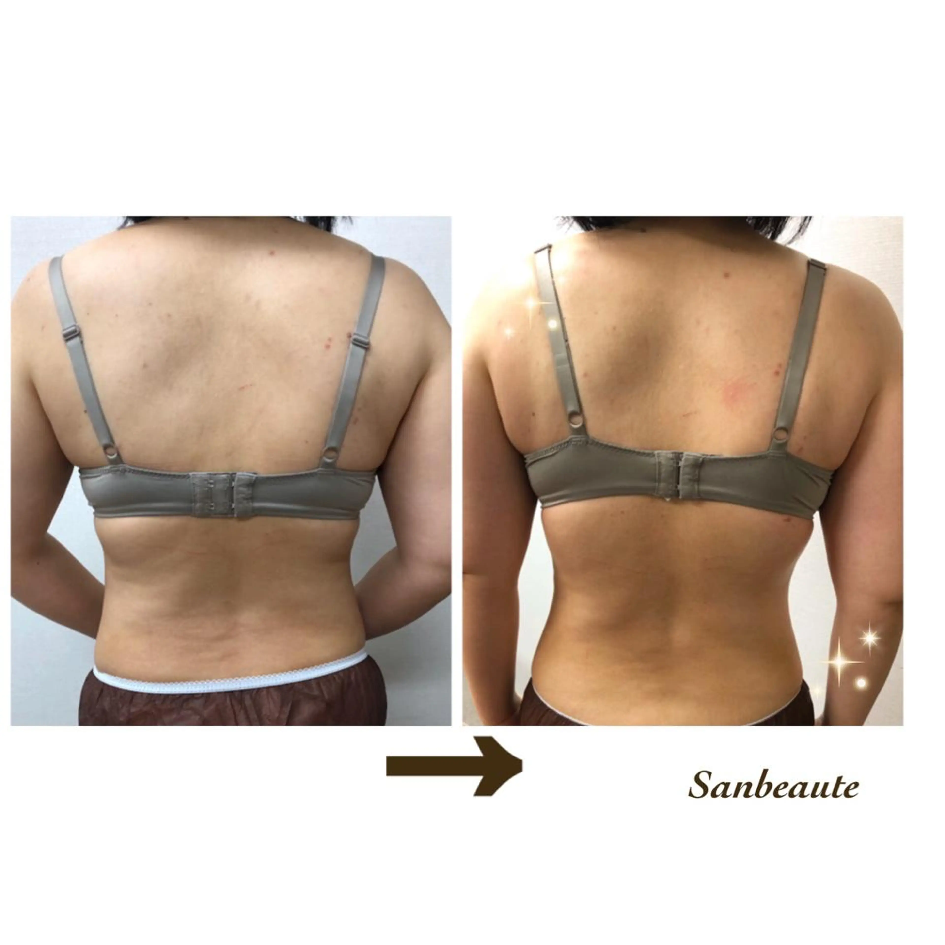 エステ Sanbeaute サンボーテのエステ・リラクイメージ