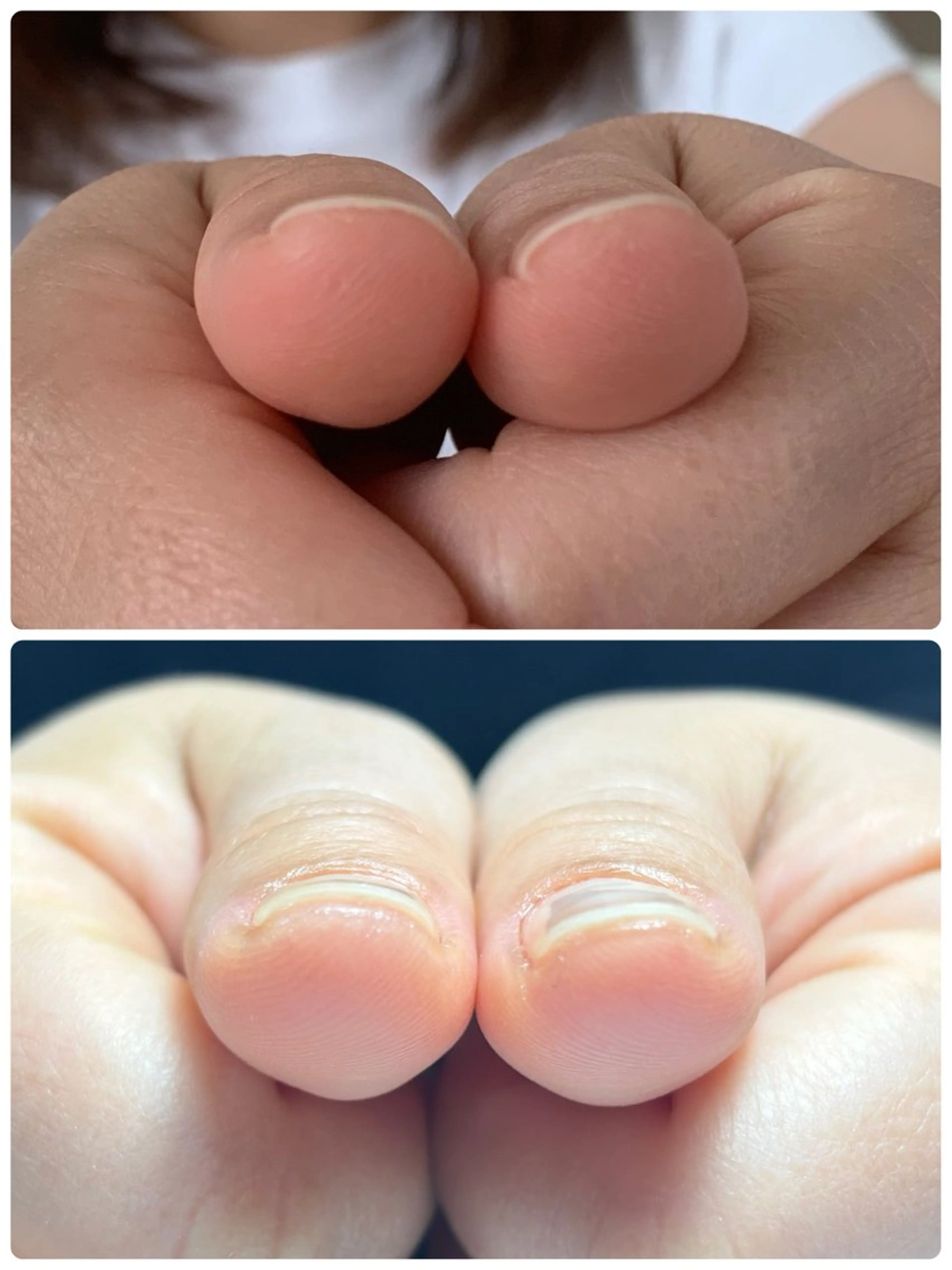 ネイル ハンドネイル Alo.nail アロ•ネイルのネイルデザイン