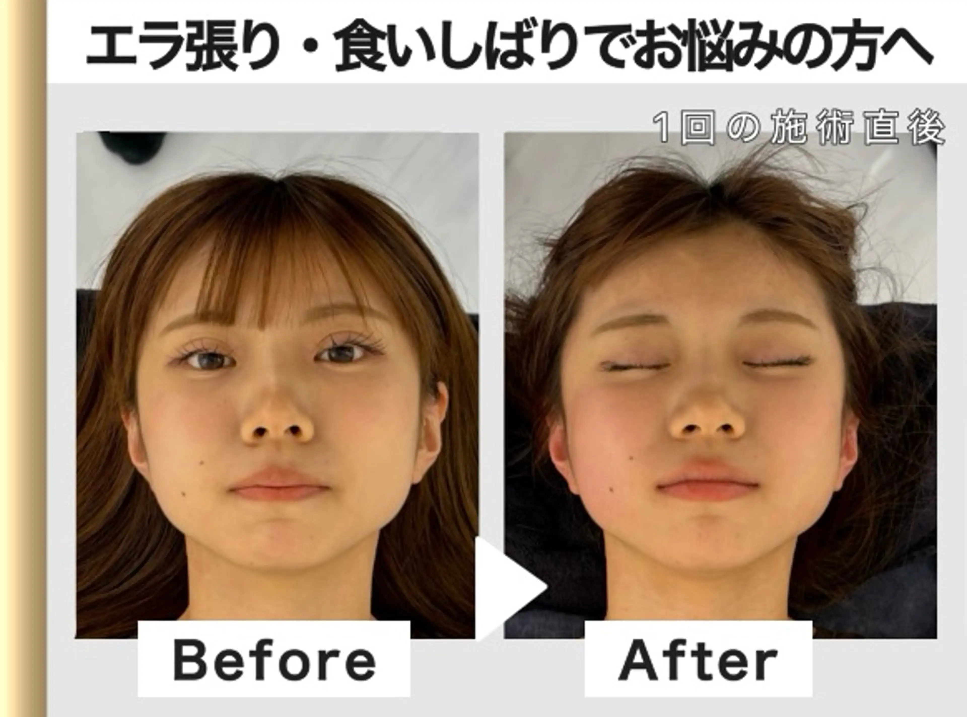 エステ リラク 小顔矯正 骨盤矯正 美容整体サロン ELVISA TOKYO 恵比寿院所属・古川 智也のエステ・リラクイメージ