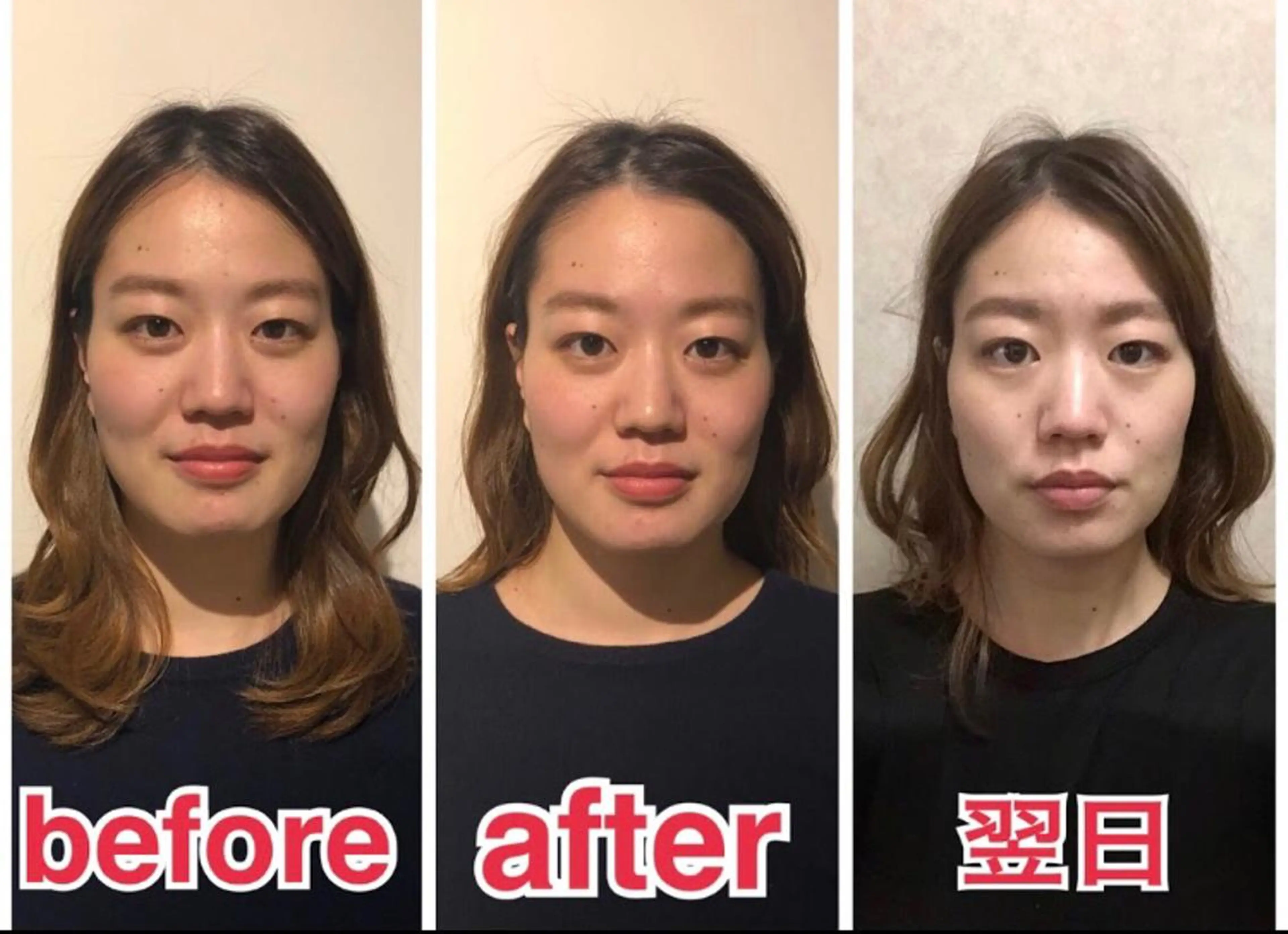 小顔矯正専門サロンジュマリ所属・町田 淳子のエステ・リラクイメージ