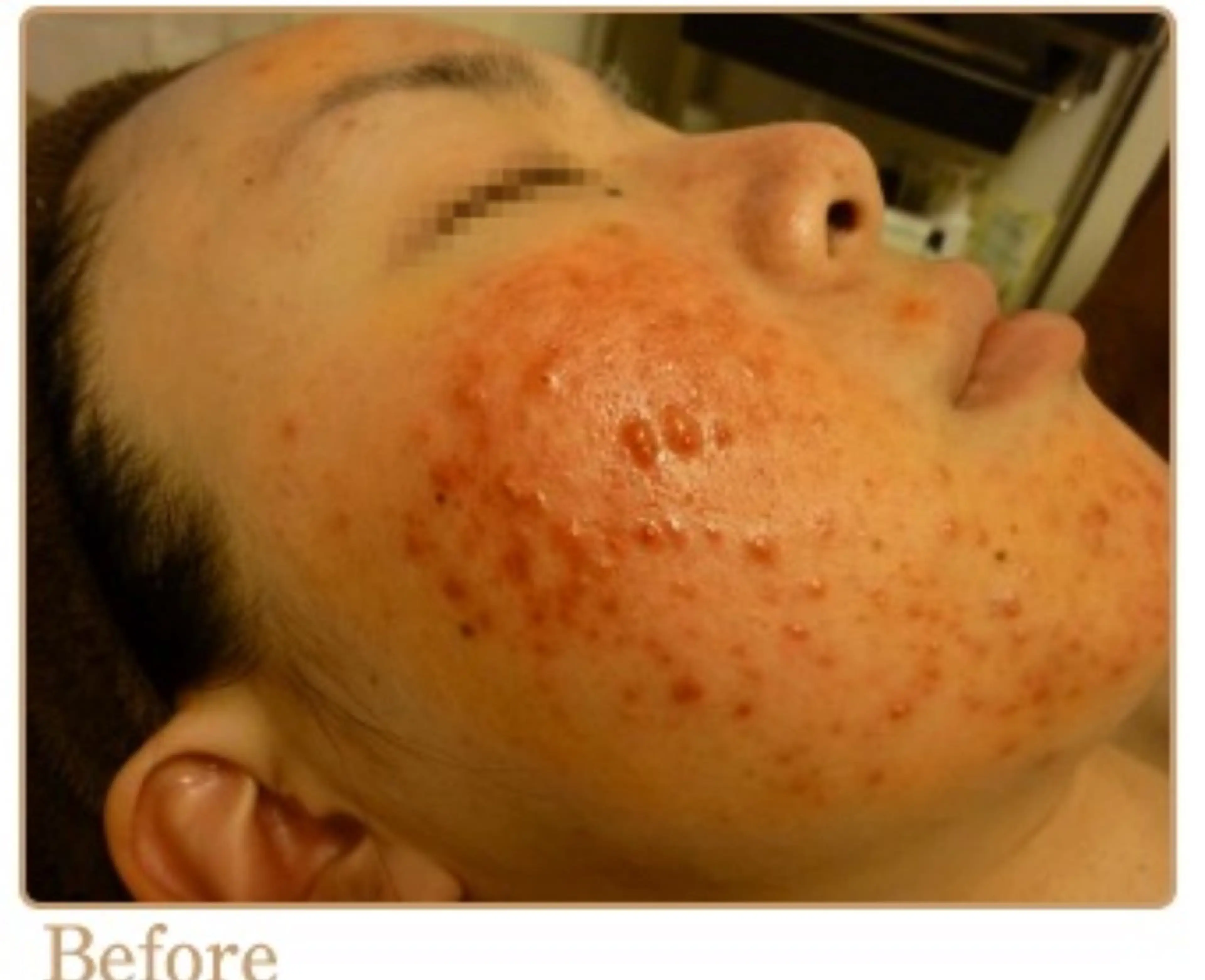 ピーリングサロン シャンテール所属・ピーリングサロン シャンテールのエステ・リラクイメージ