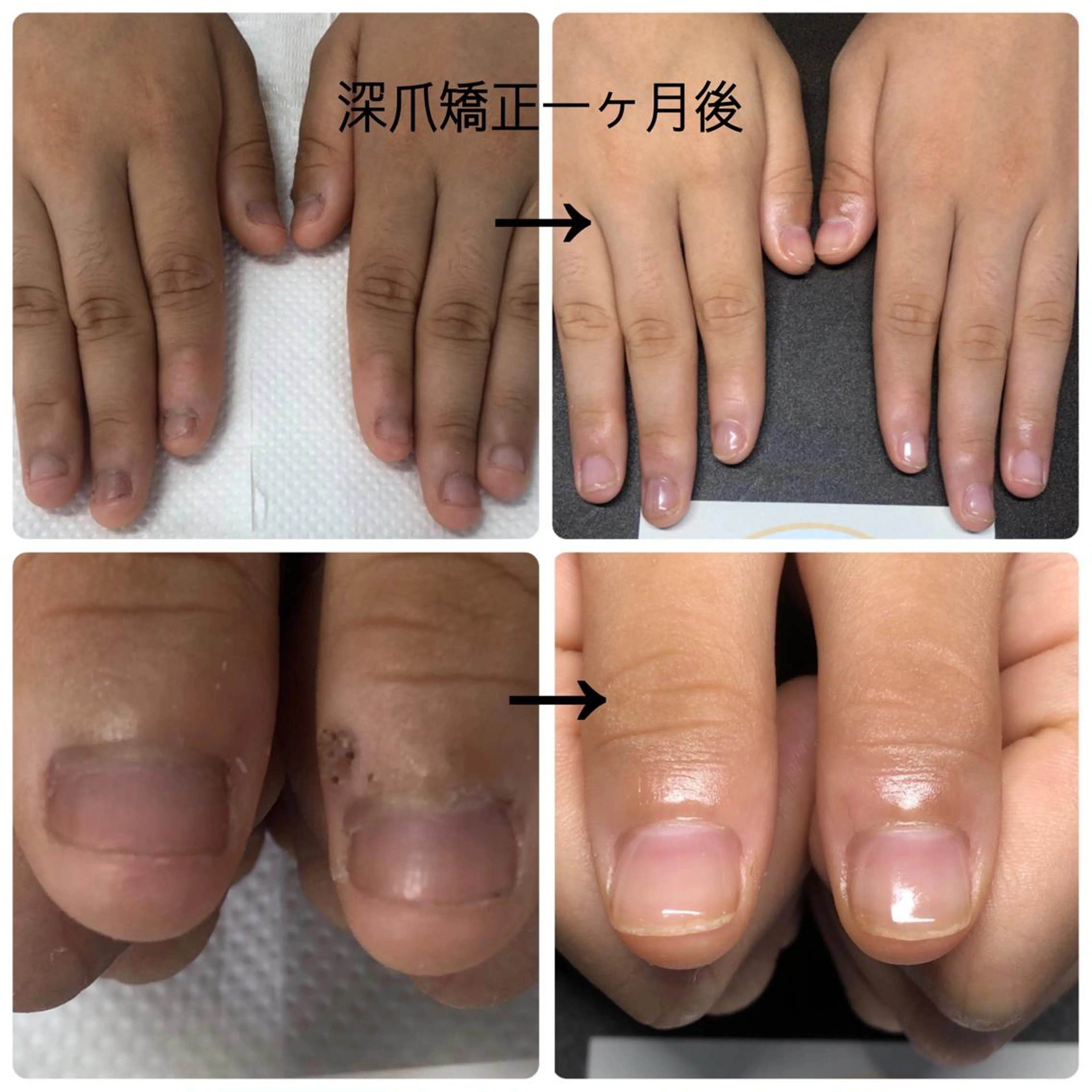 ネイル Nojima mのネイルデザイン