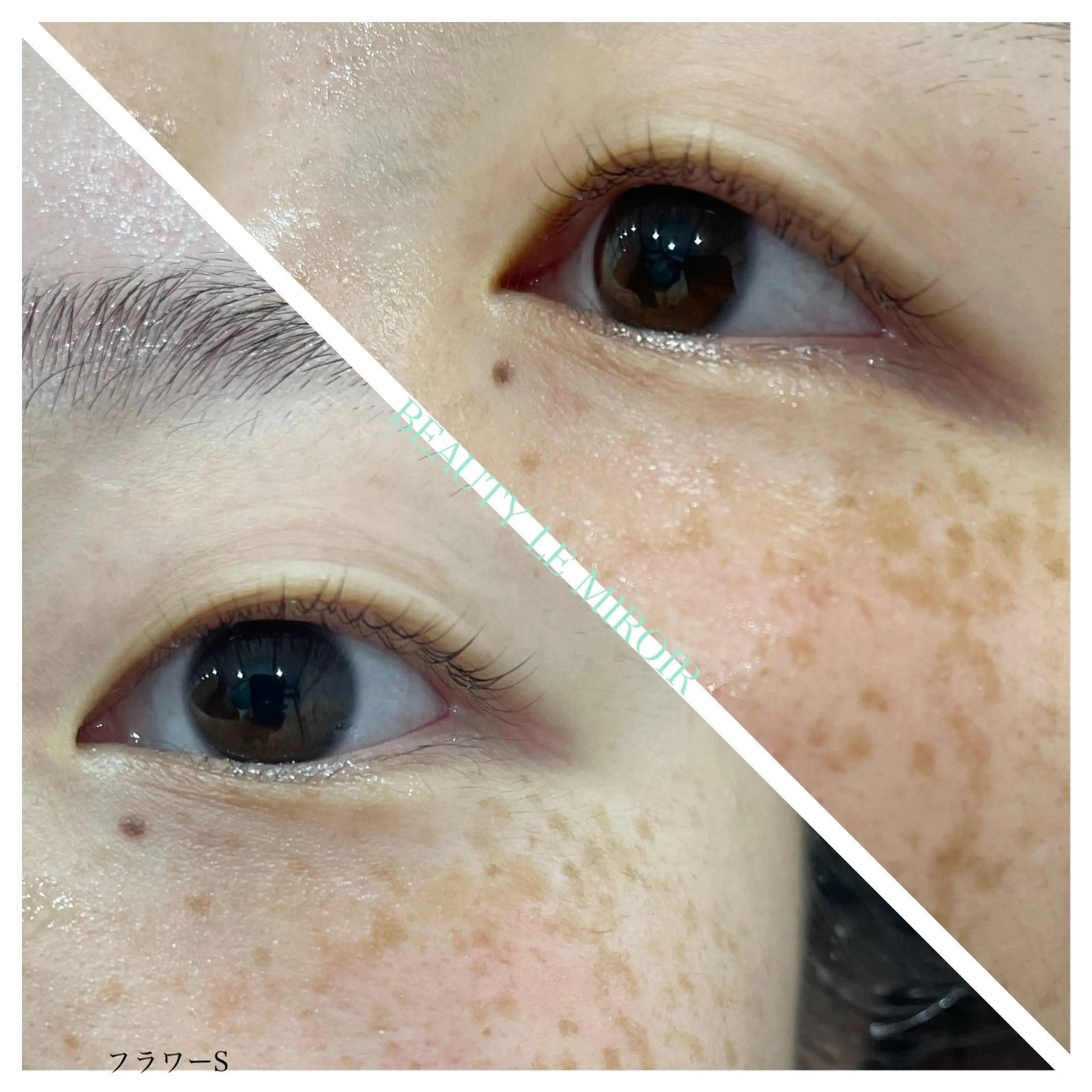 マツエク・マツパ ビューティー ミロワールのエステ・リラクイメージ