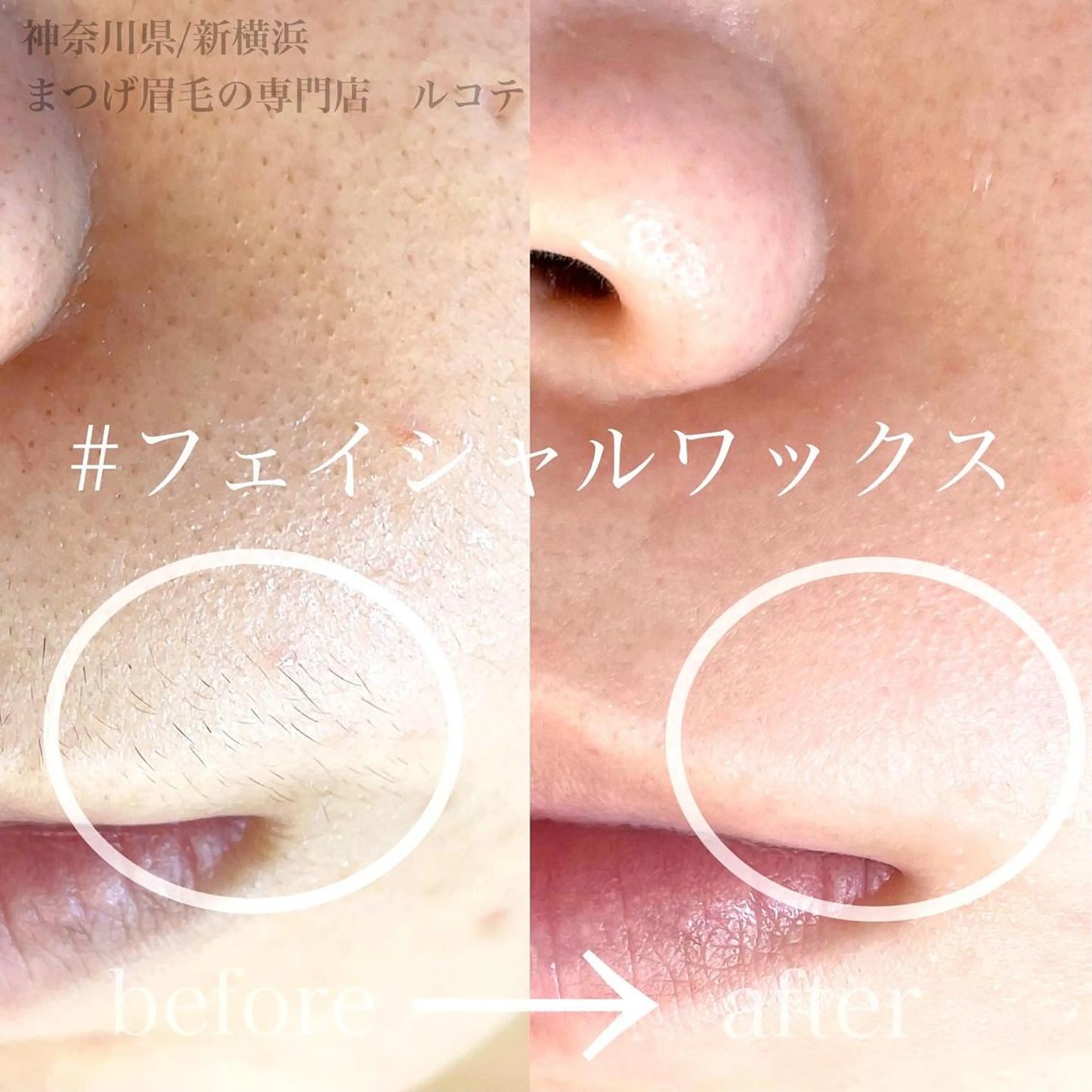 脱毛 アイラッシュサロン ルコテの眉毛・アイブロウイメージ