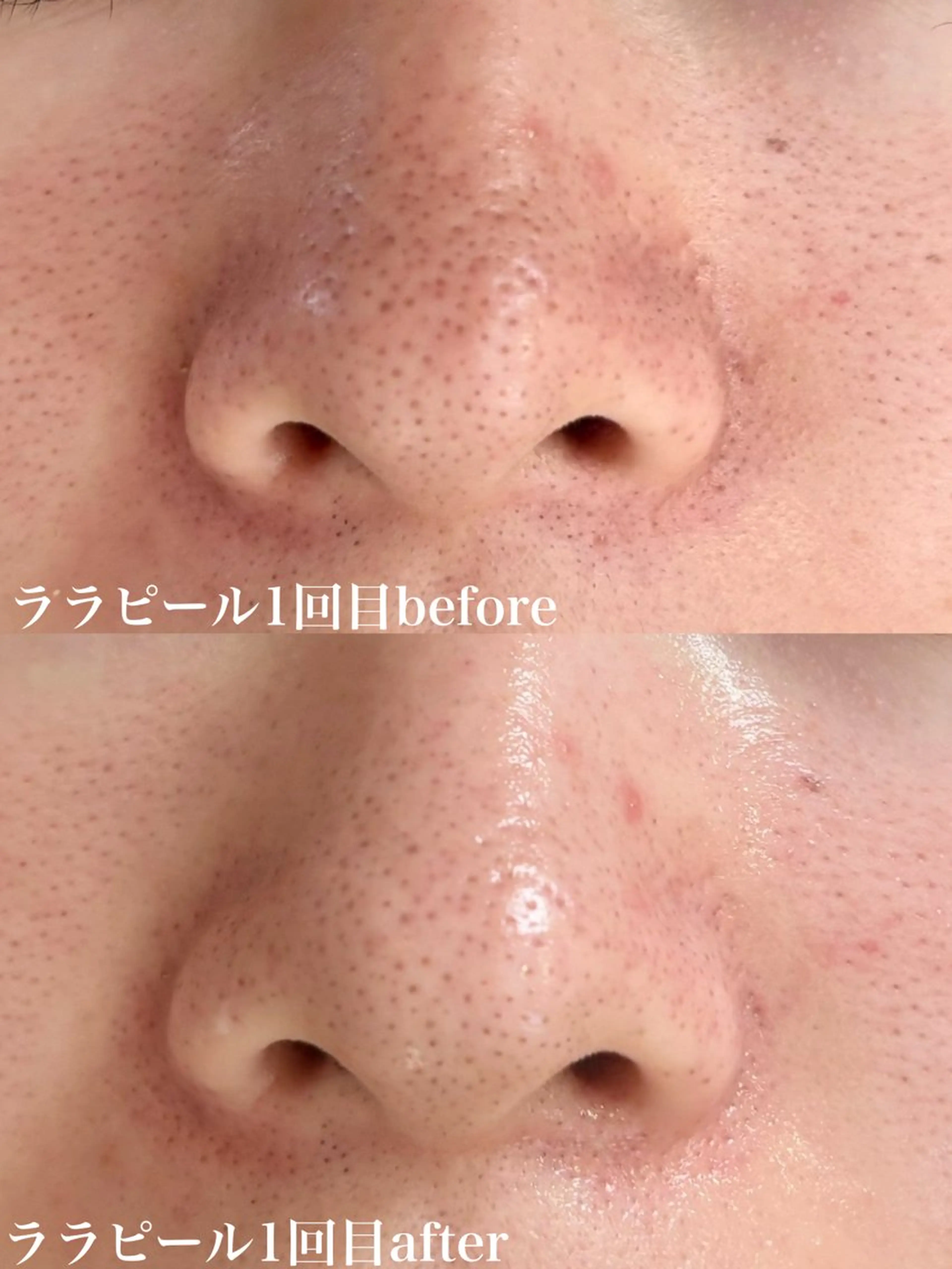 WHITE AQUA 北千住店のエステ・リラクイメージ