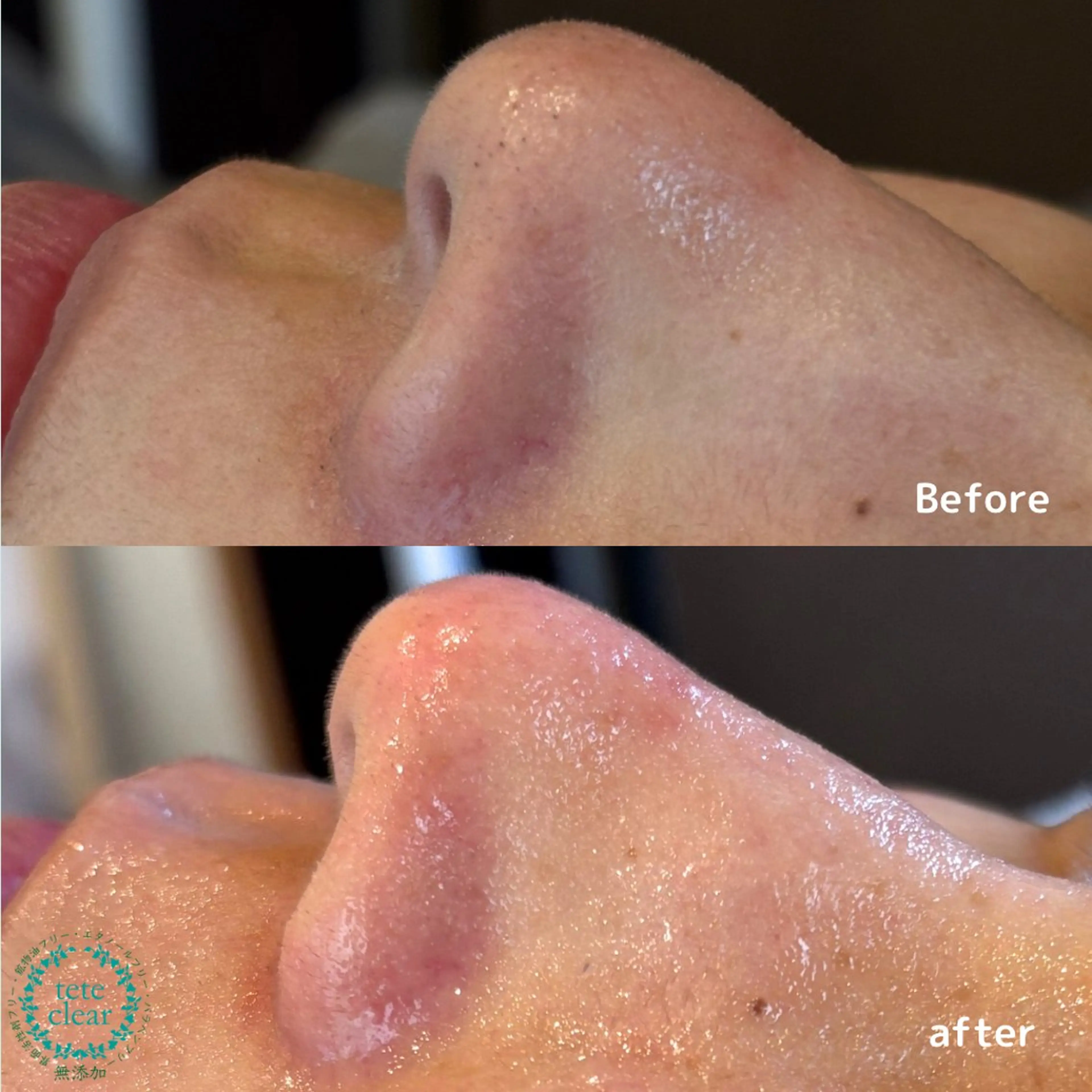 毛穴専門店 le e'rableのその他イメージ